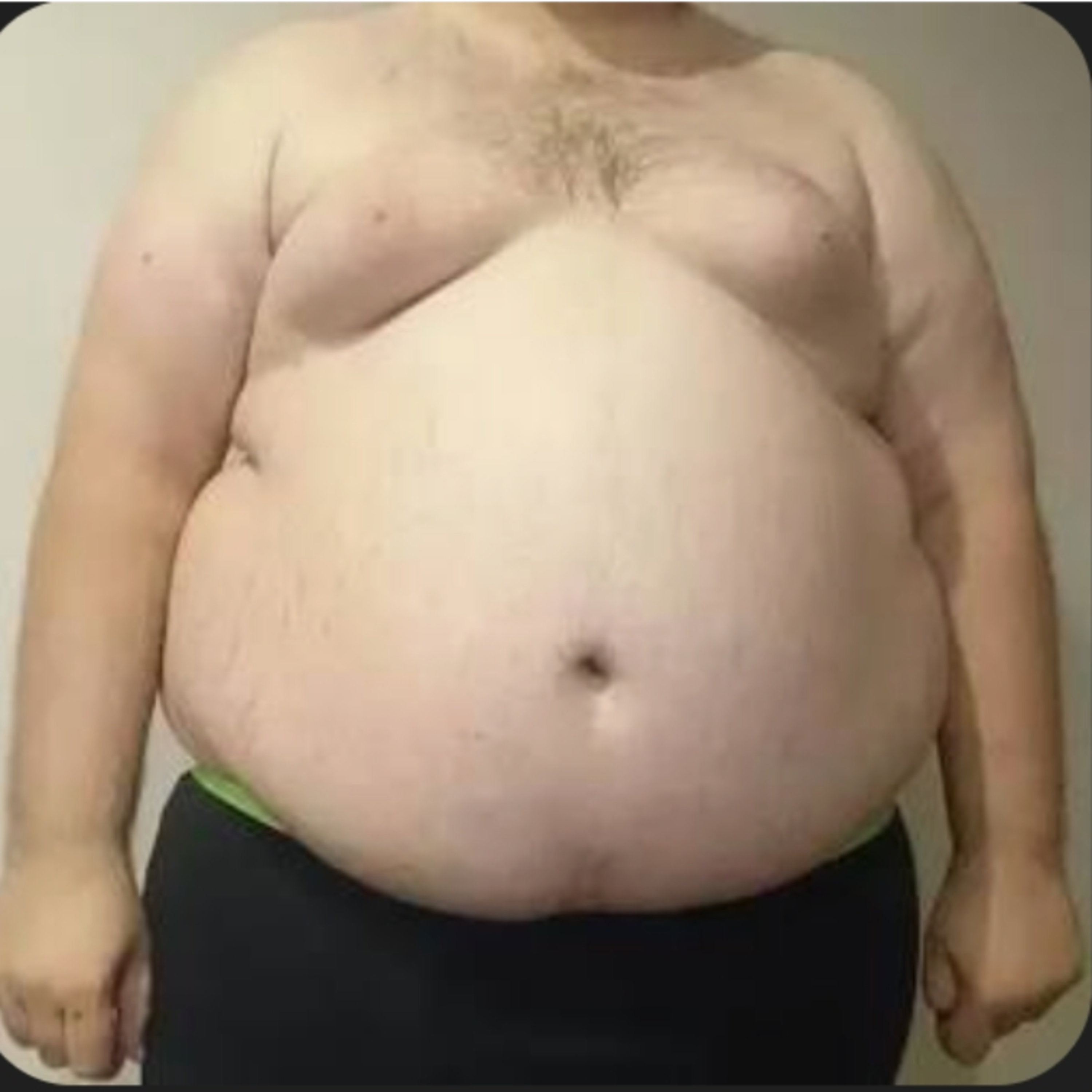 Is it normal to have a big belly, aka dad bod? episode artwork