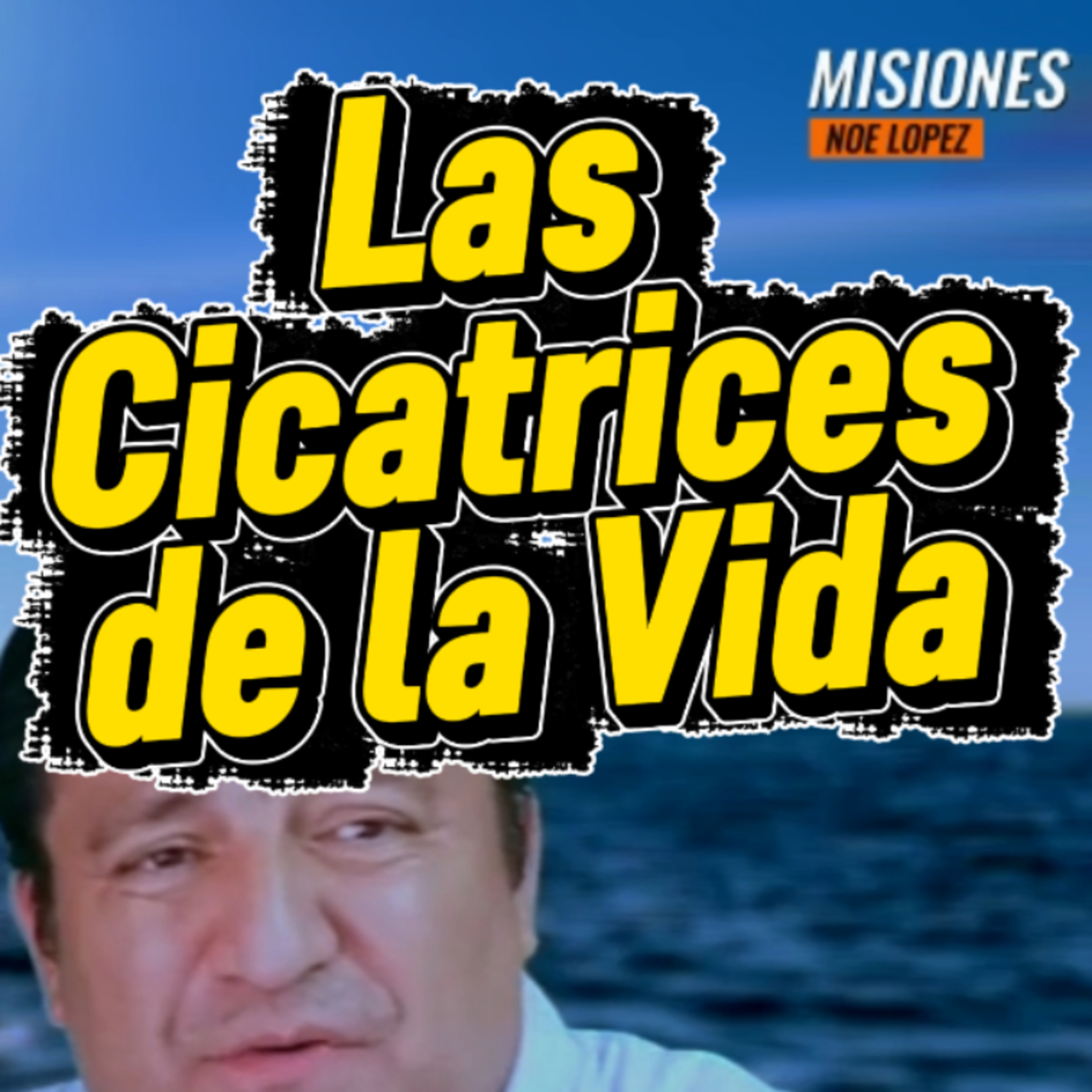 #3 🤕 "LAS CICATRICES DE LA VIDA"👀 🎯Sigue Toda La Serie en YouTube/NoeLopezOficial #cicatrices episode artwork