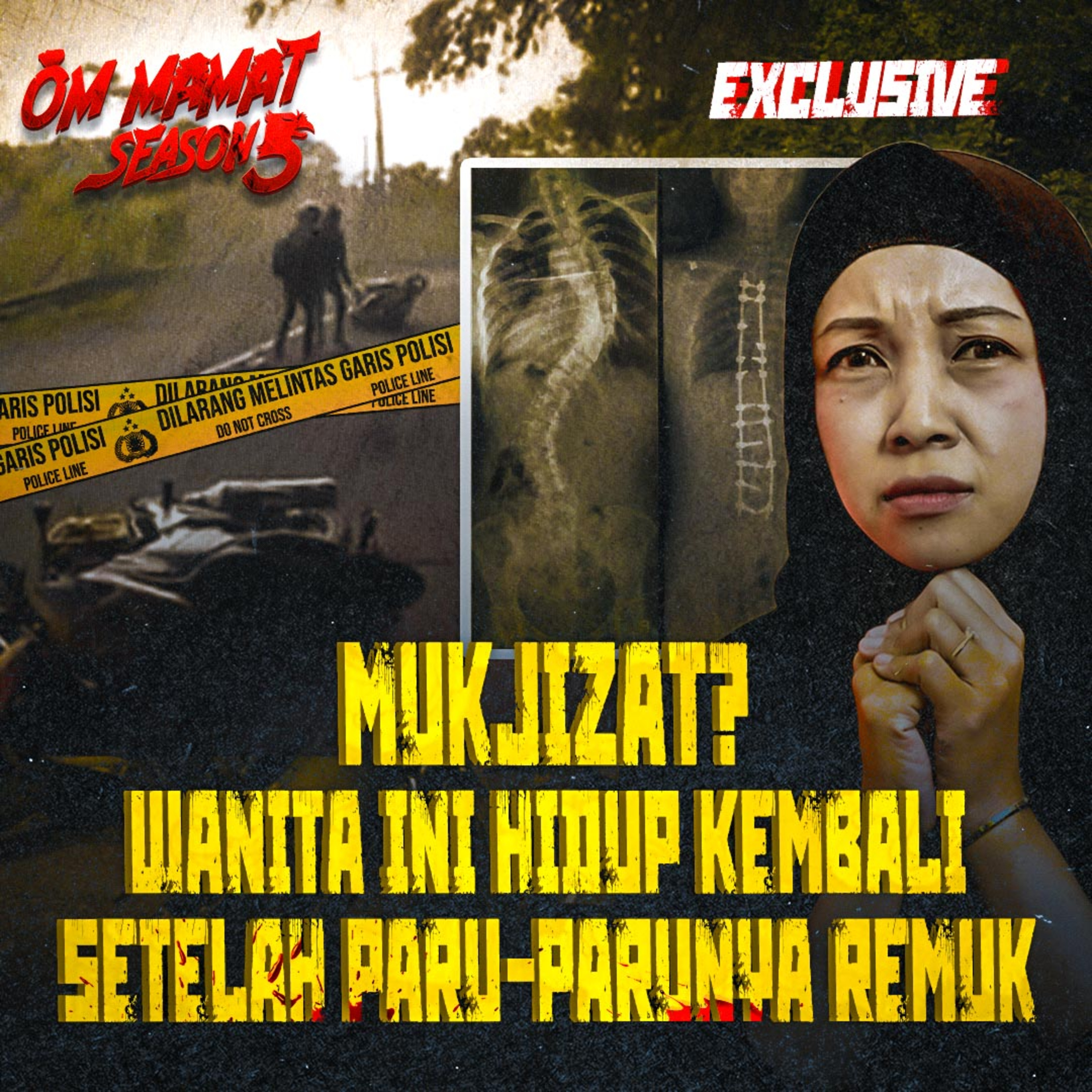 315. DINYATAKAN MENINGGAL, WANITA INI HIDUP KEMBALI SETELAH PARU2 & TULANGNYA REMUK episode artwork