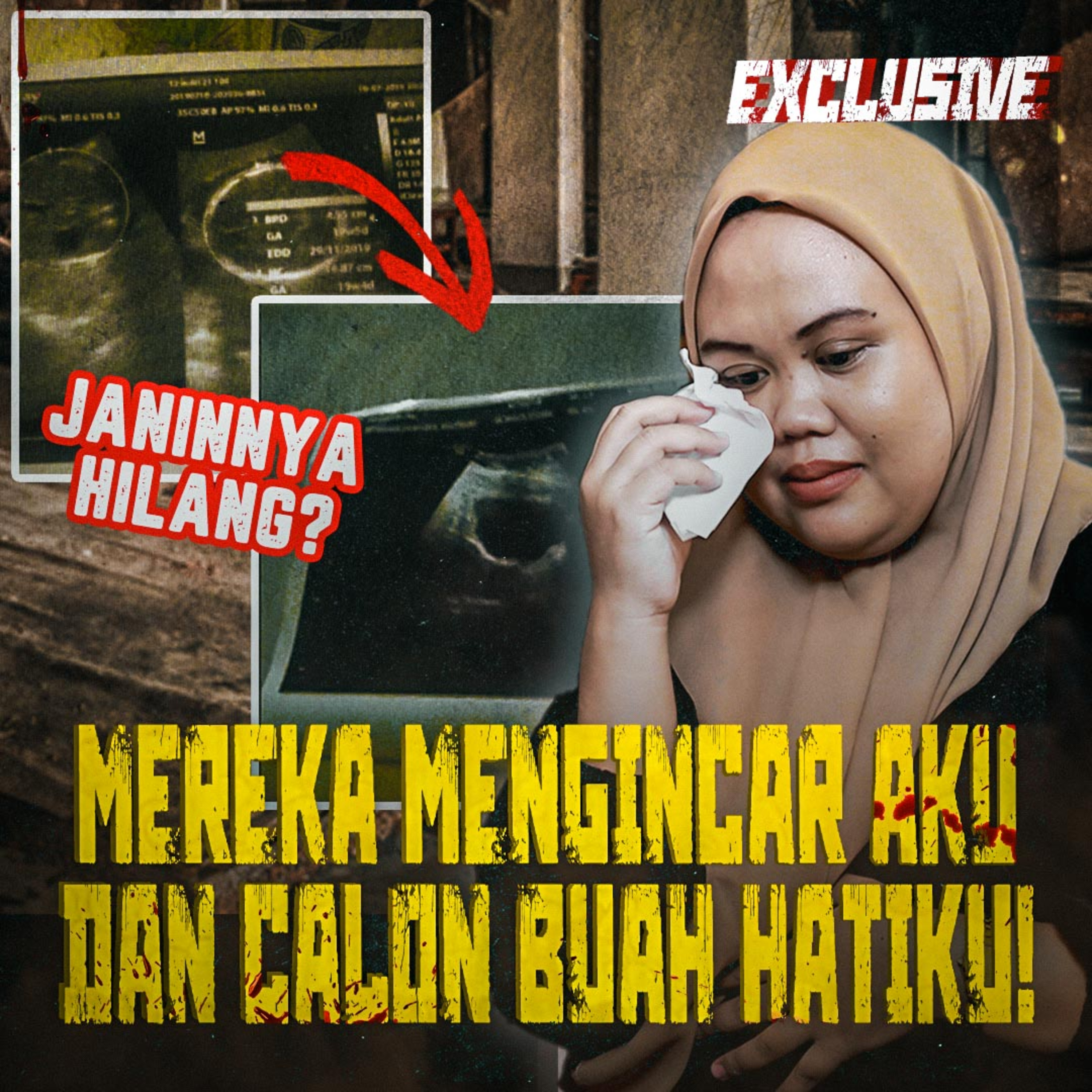 383. ANEH TAPI NYATA? 7 BULAN BAYI HILANG DALAM PERUT.. ANAKKU HILANG KEMANA??!