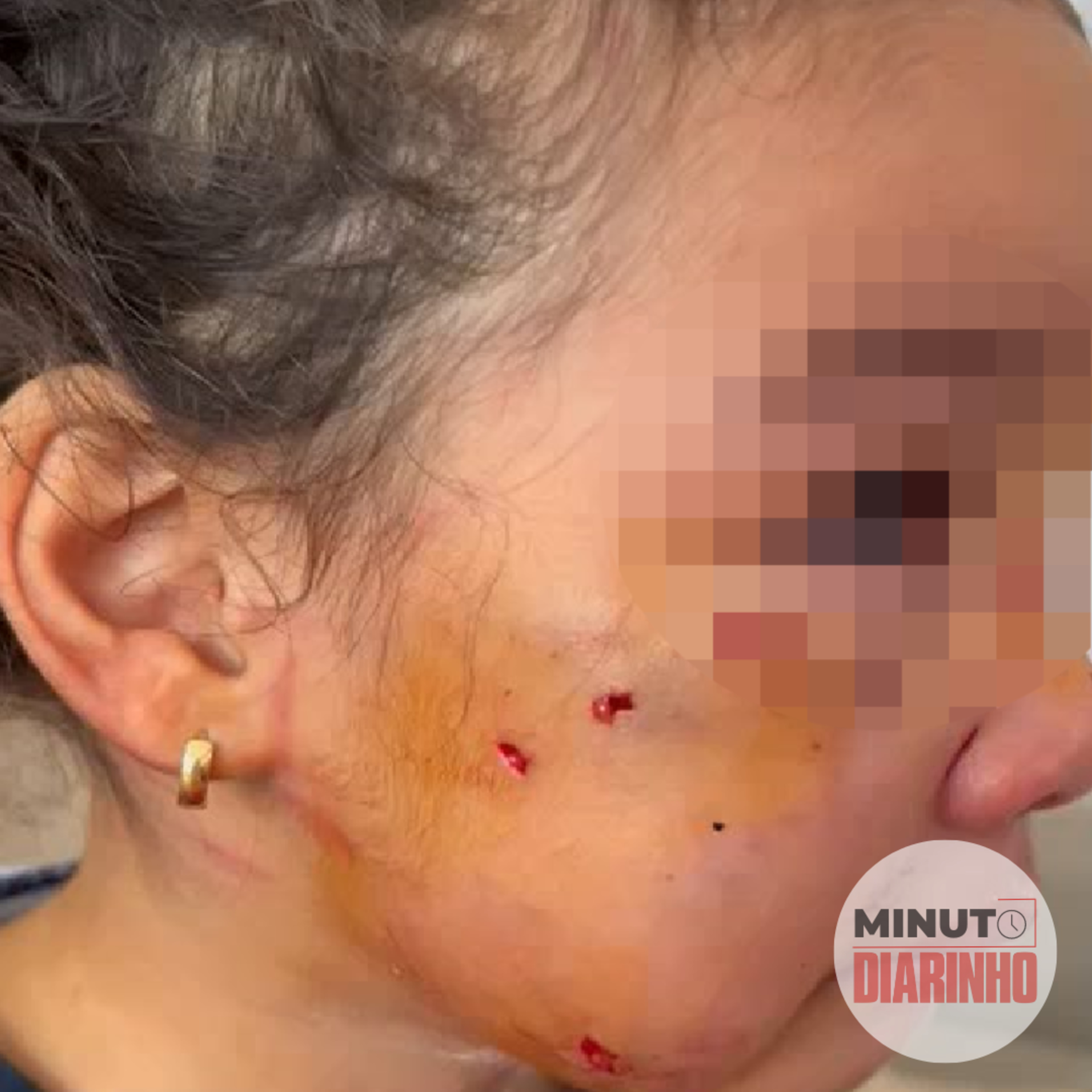 Menina é atacada por pit bull em pracinha episode artwork