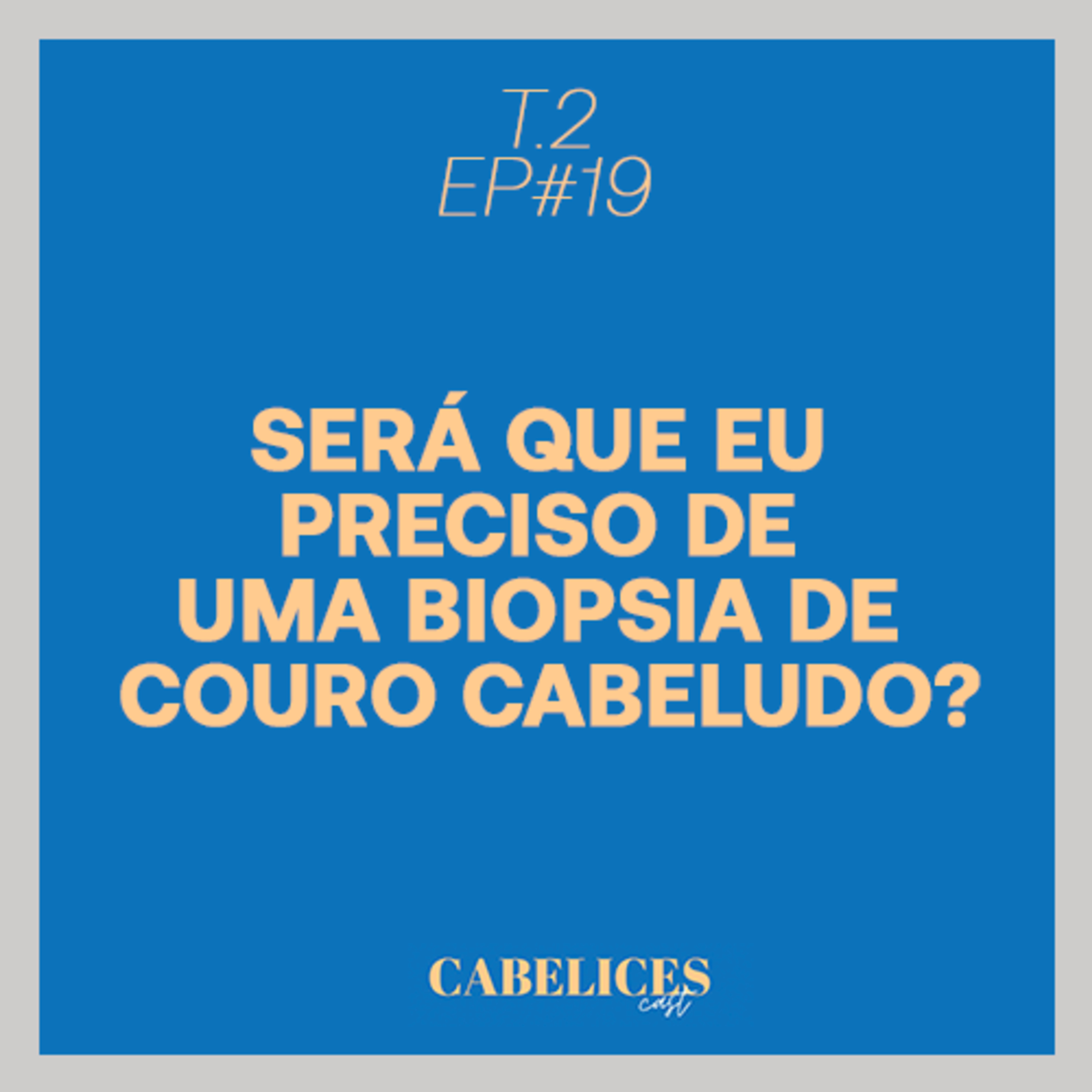 Cabelices Cast