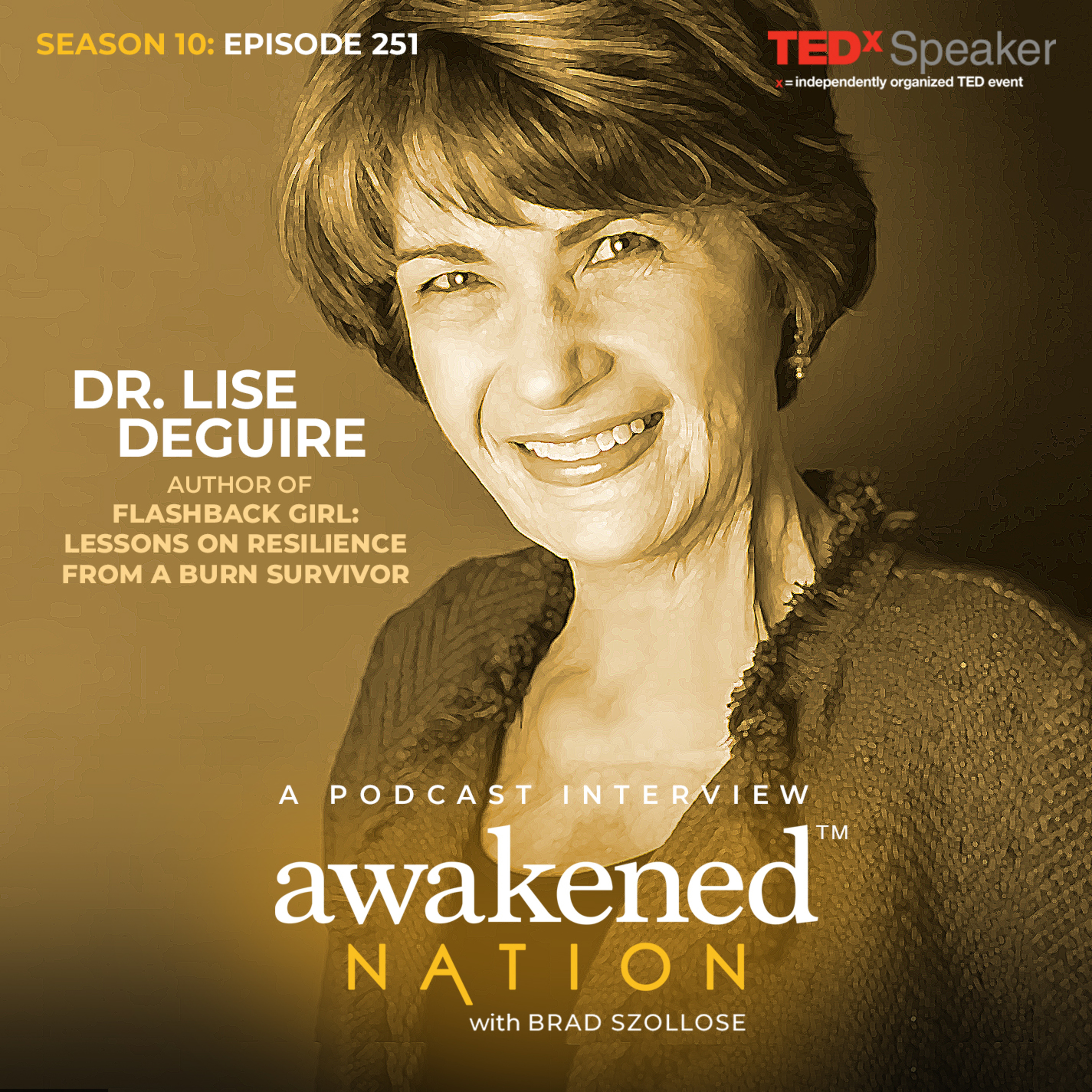 Scarred, But Not Scary: an interview with Burn Survivor Dr. Lise Deguire episode artwork