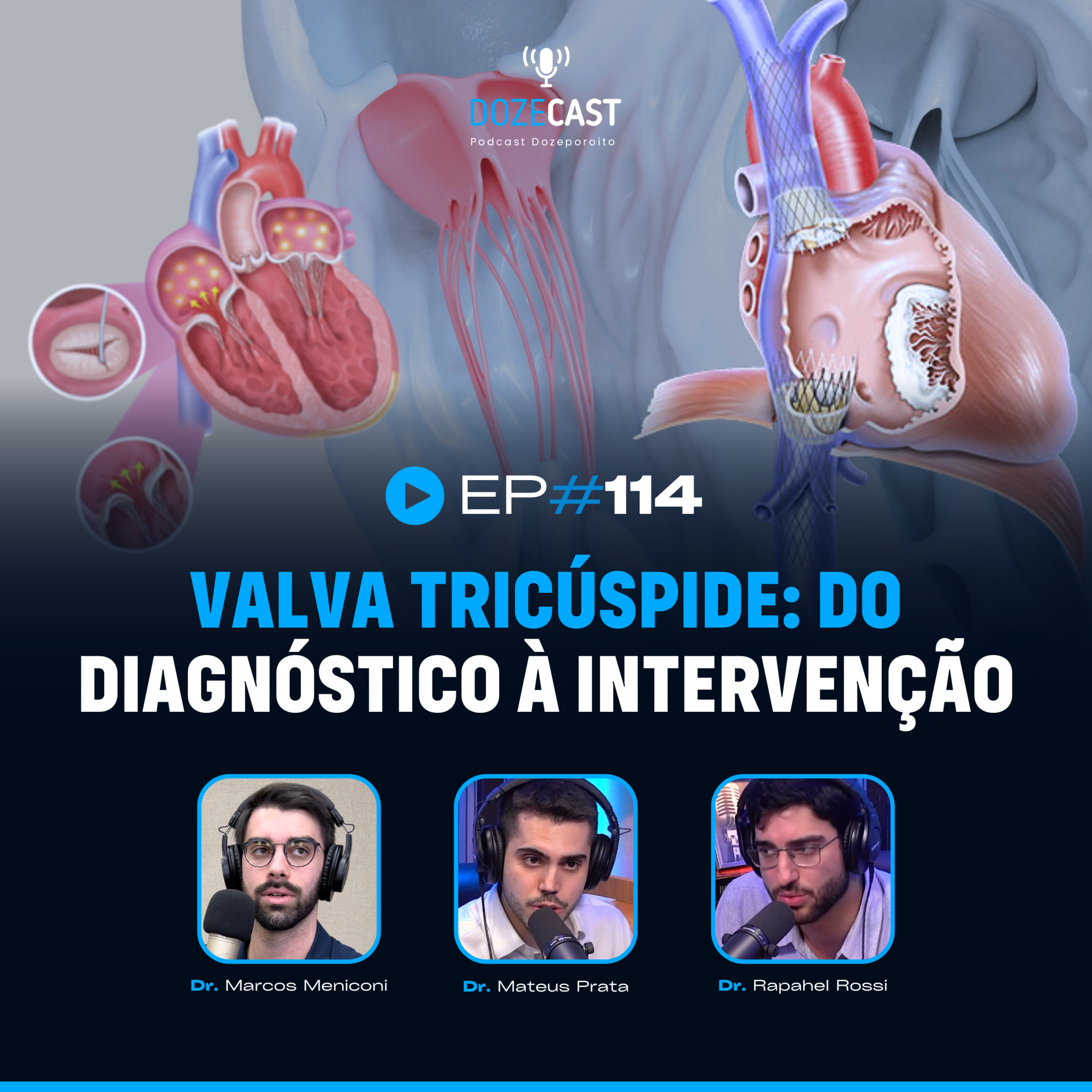 DozeCast - Cardiologia