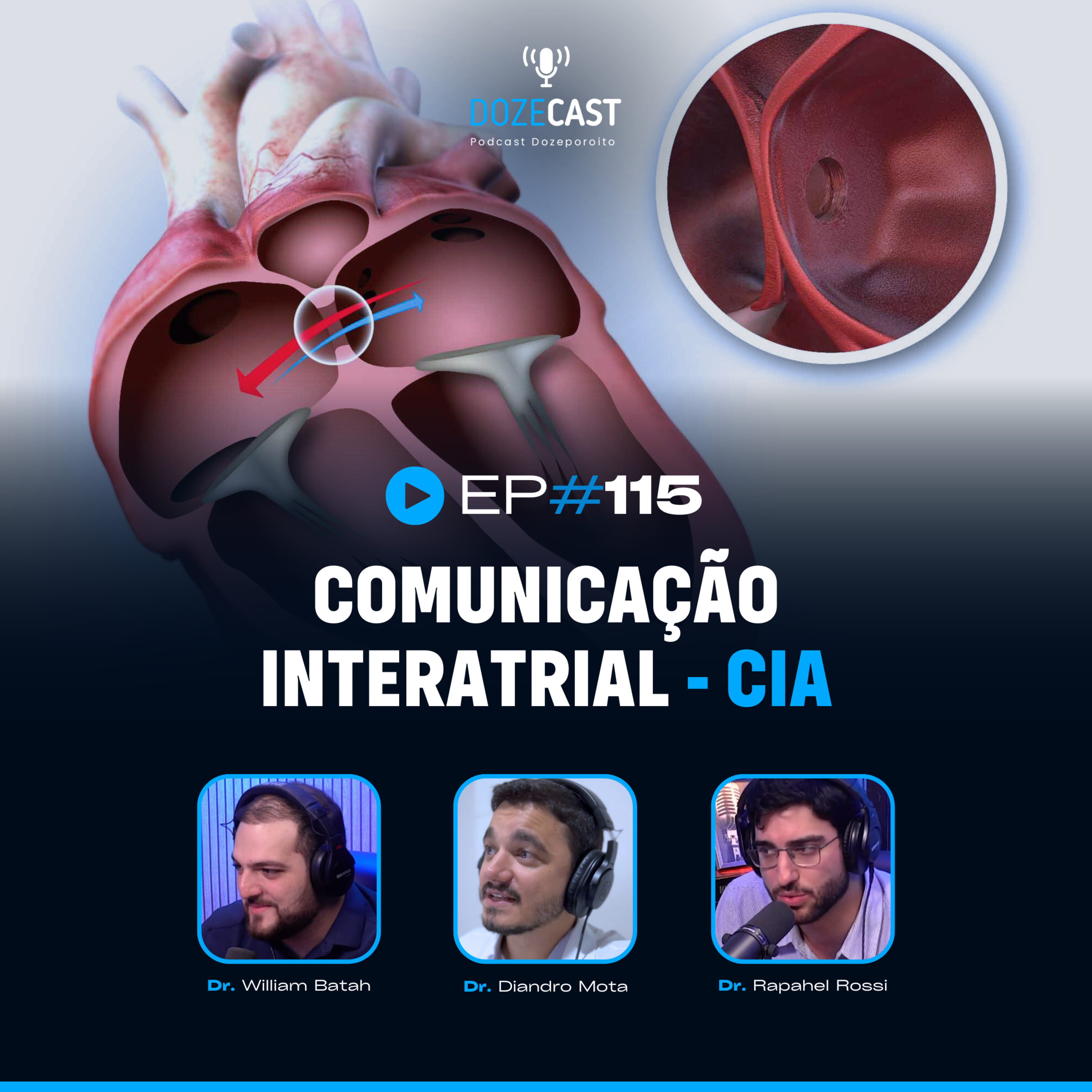 DozeCast - Cardiologia
