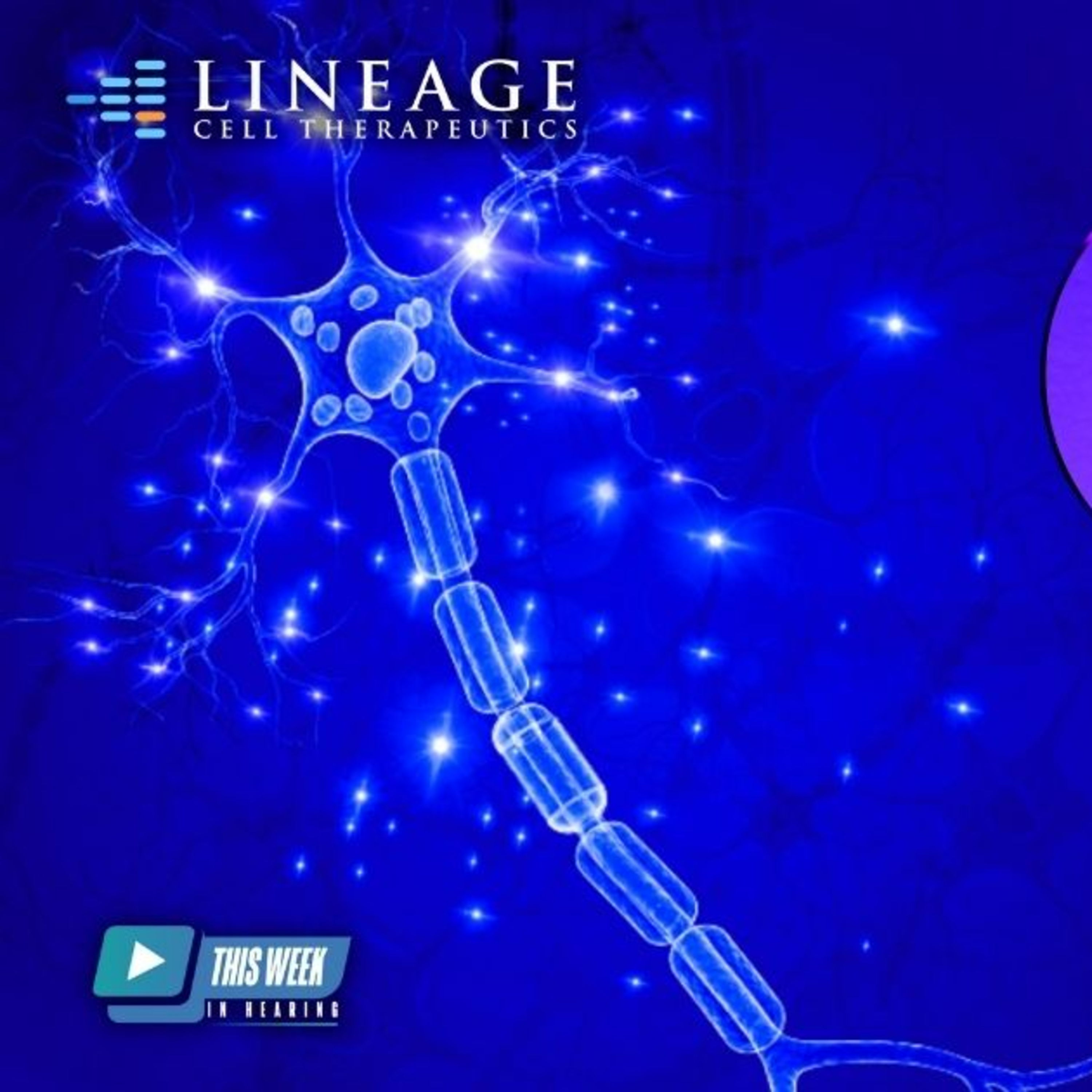 142 - Manufacturing Auditory Neurons with Brian Culley, CEO of Lineage Cell Therapeutics episode artwork