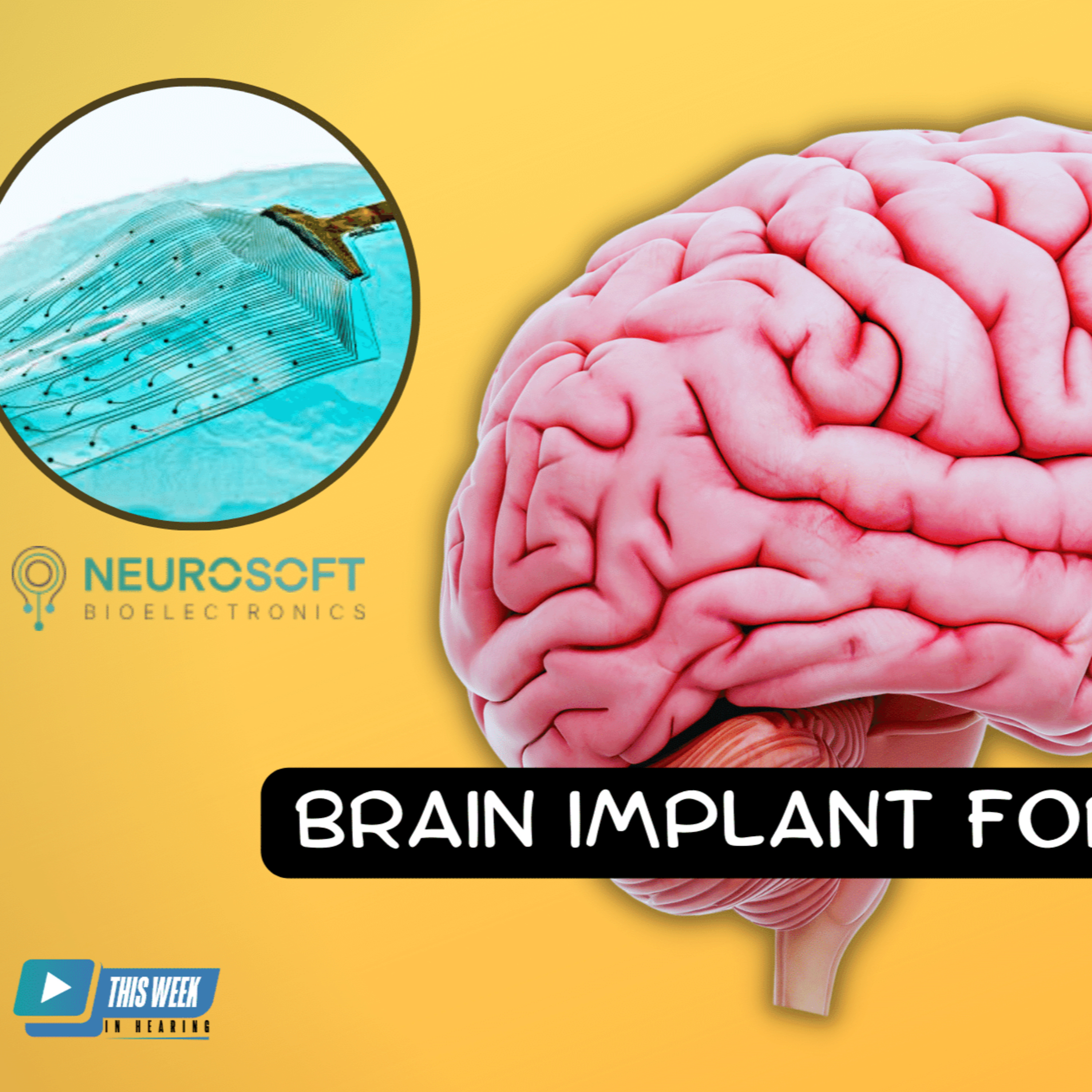 179 - Could Severe Tinnitus be Treated with a Brain Implant? New Technology Under Development Holds Promise episode artwork