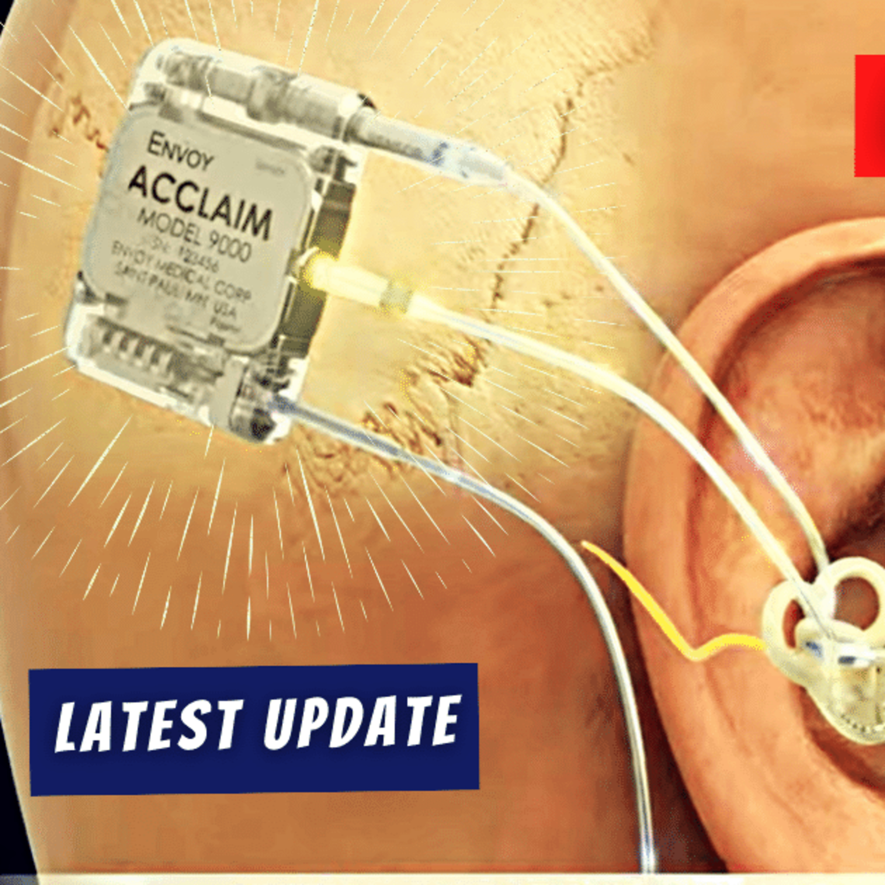 This Week in Hearing