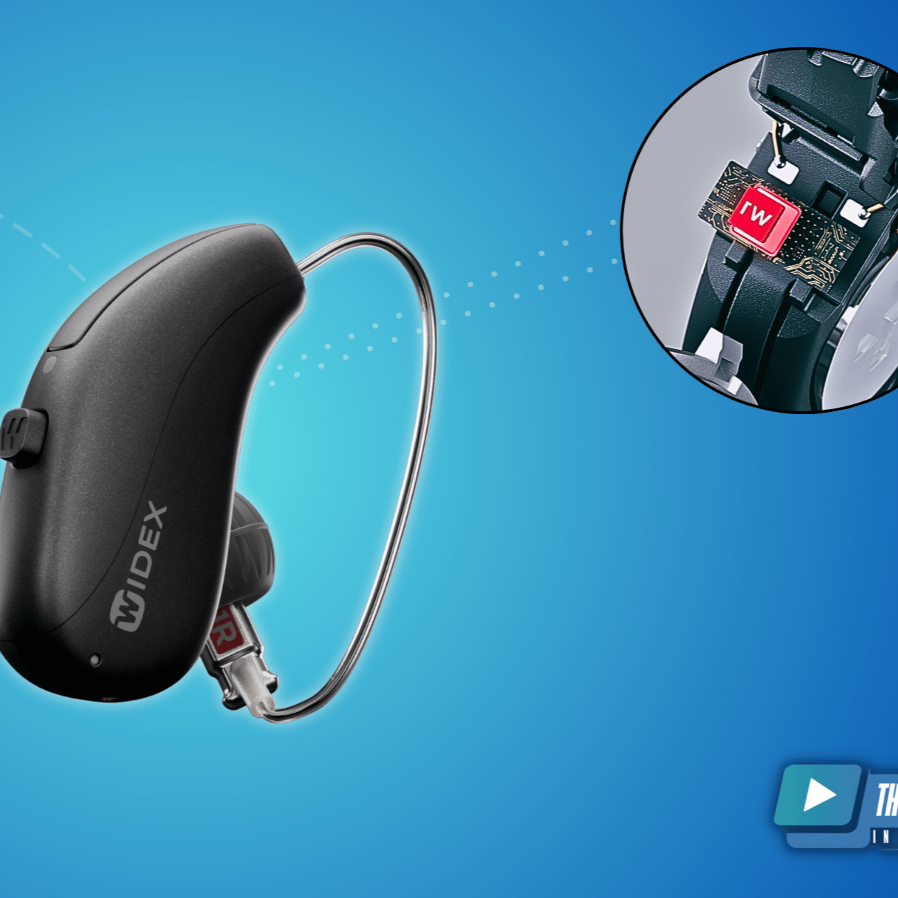 270 - Exploring Widex Allure Hearing Aids: W1 Chip, Cloud Fitting, and Advanced Sound Control episode artwork