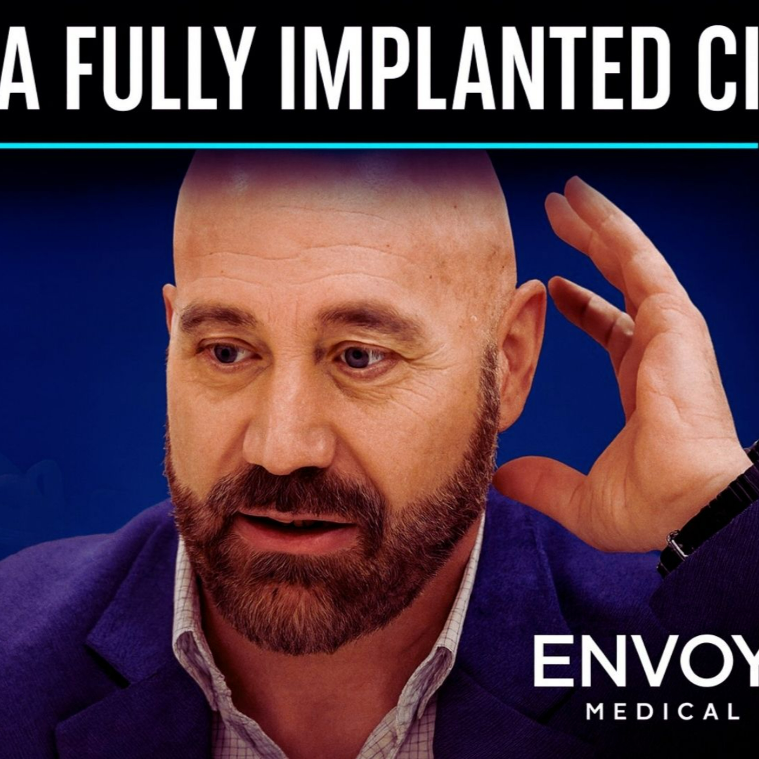 321 - Life With a Fully Implanted Cochlear Implant: Michael Seufer Shares His Experience episode artwork