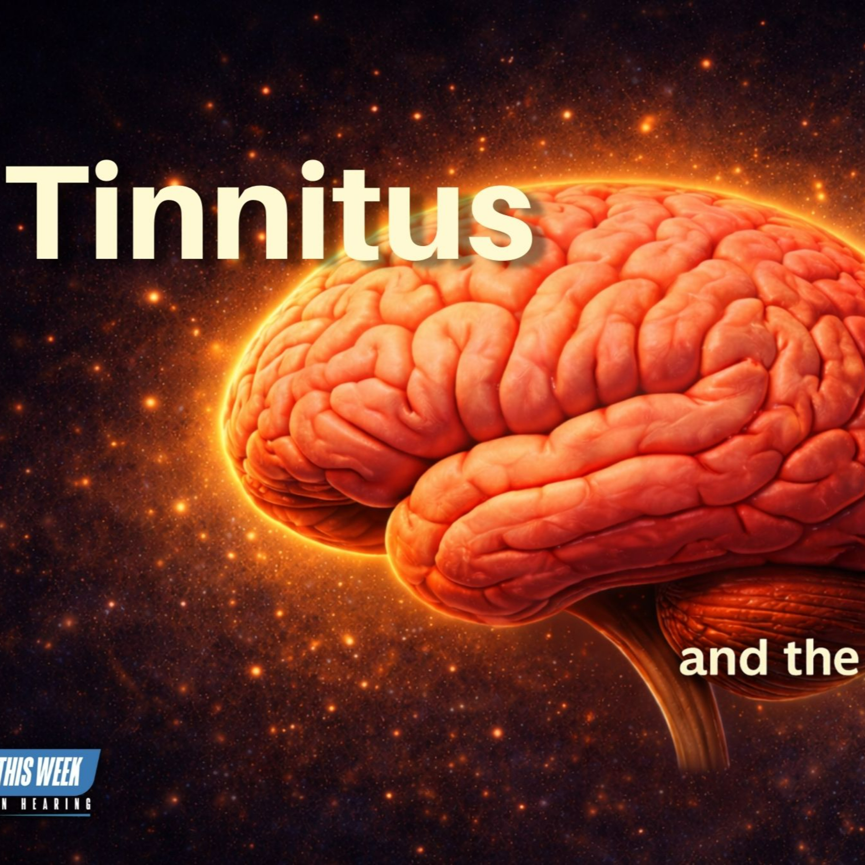 329 - A Brain-Based Approach to Understanding and Managing Tinnitus episode artwork