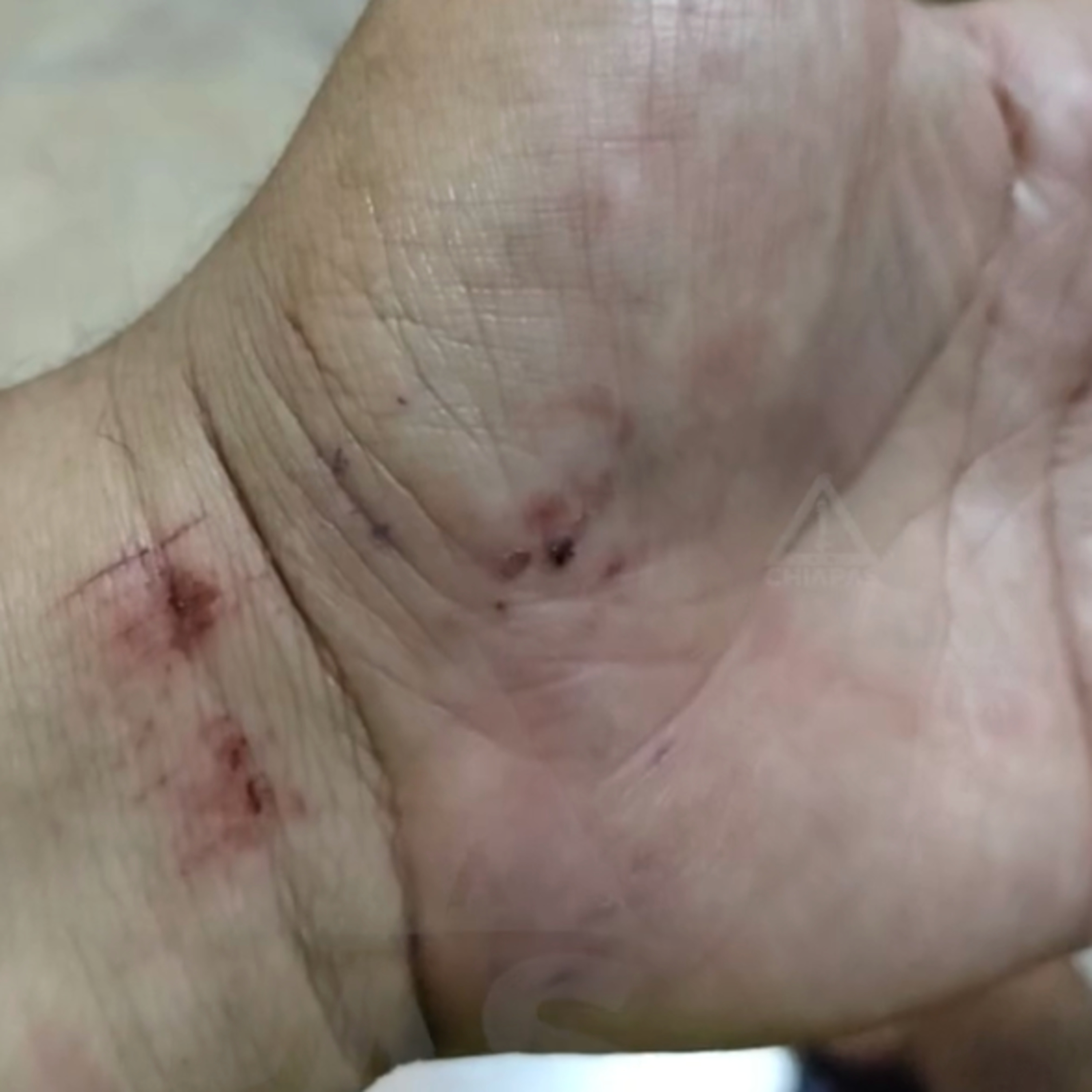 🚨 Abuso policial en Tuxtla: Comerciante denuncia agresión y robo 🚔 episode artwork