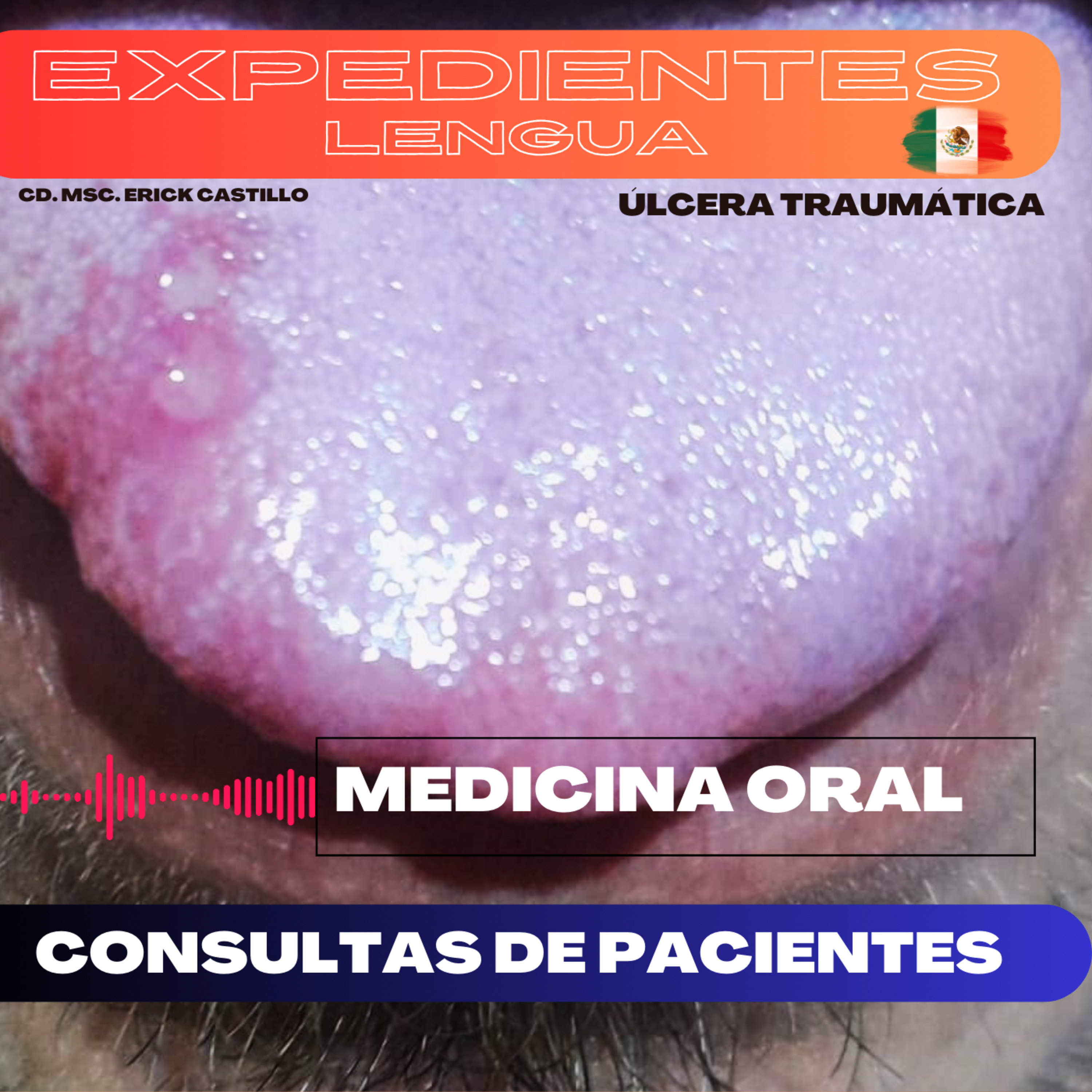 Consulta de paciente 29/02/2024 / Ulcera oral episode artwork