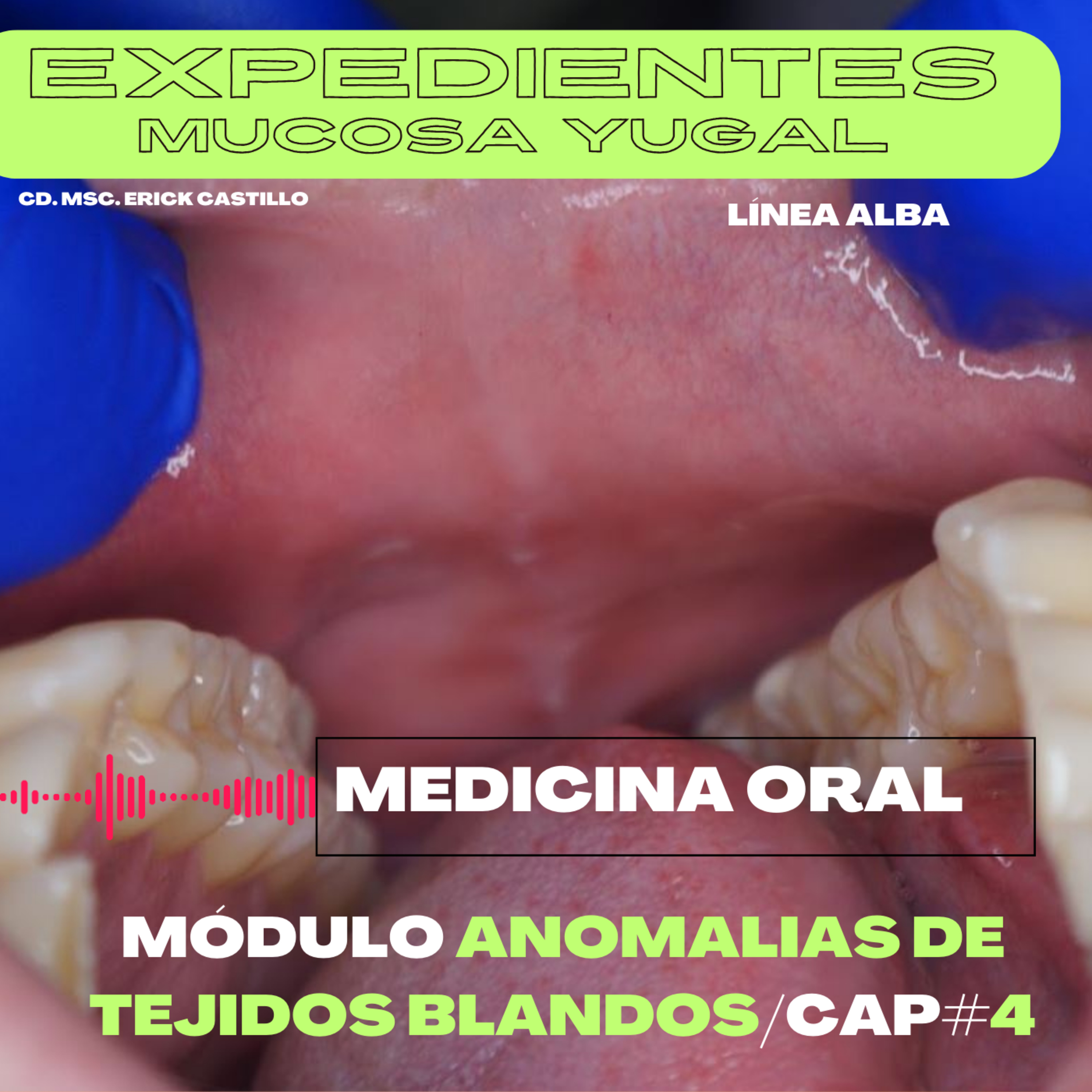 Cambios en el carrillo oral no patológicos / Cáp. # 4 episode artwork