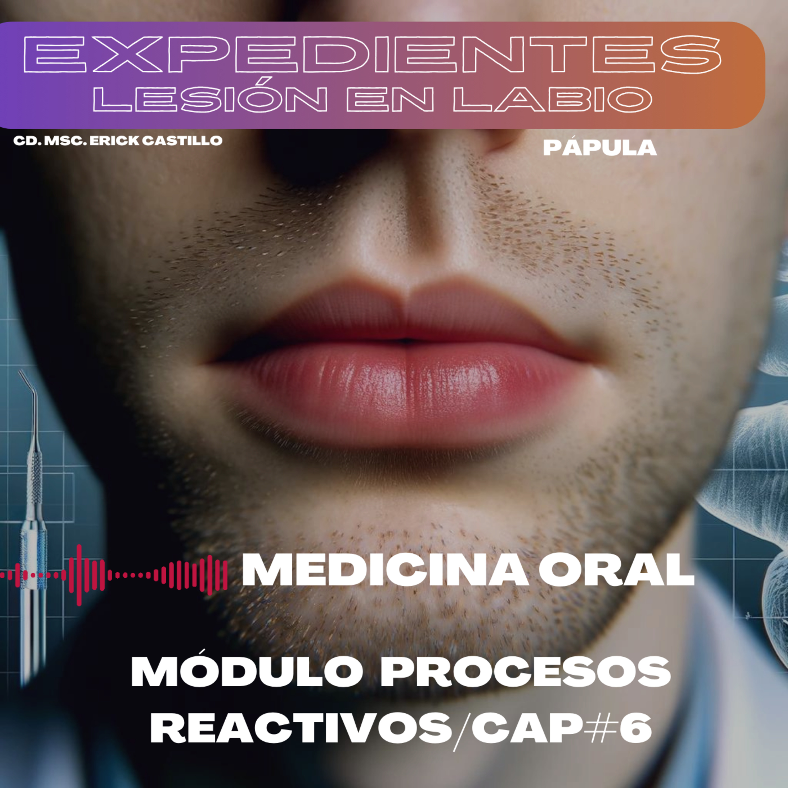 Lesión elevada en la mucosa del labio inferior episode artwork