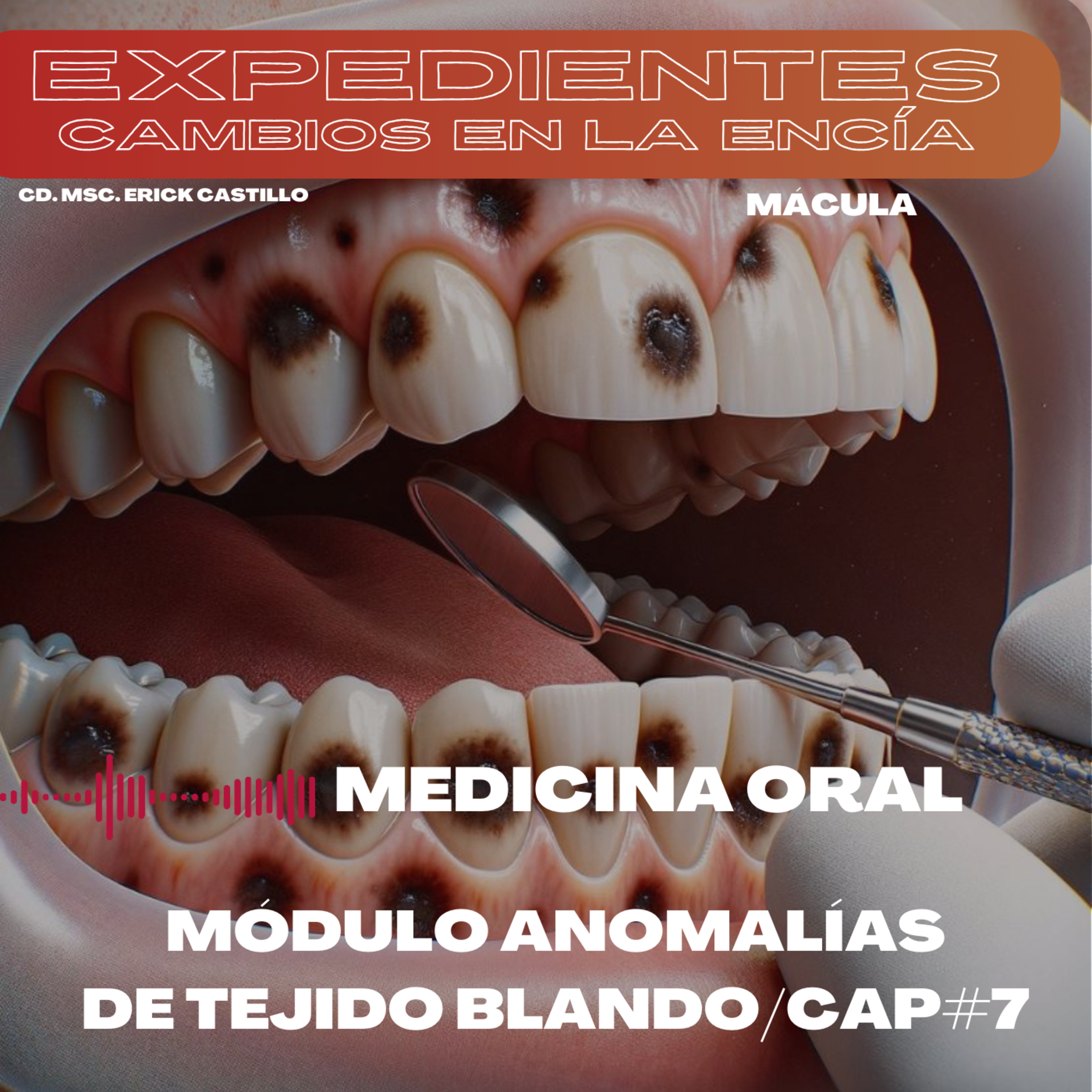 Paciente con manchas en la encía ¿qué es? episode artwork