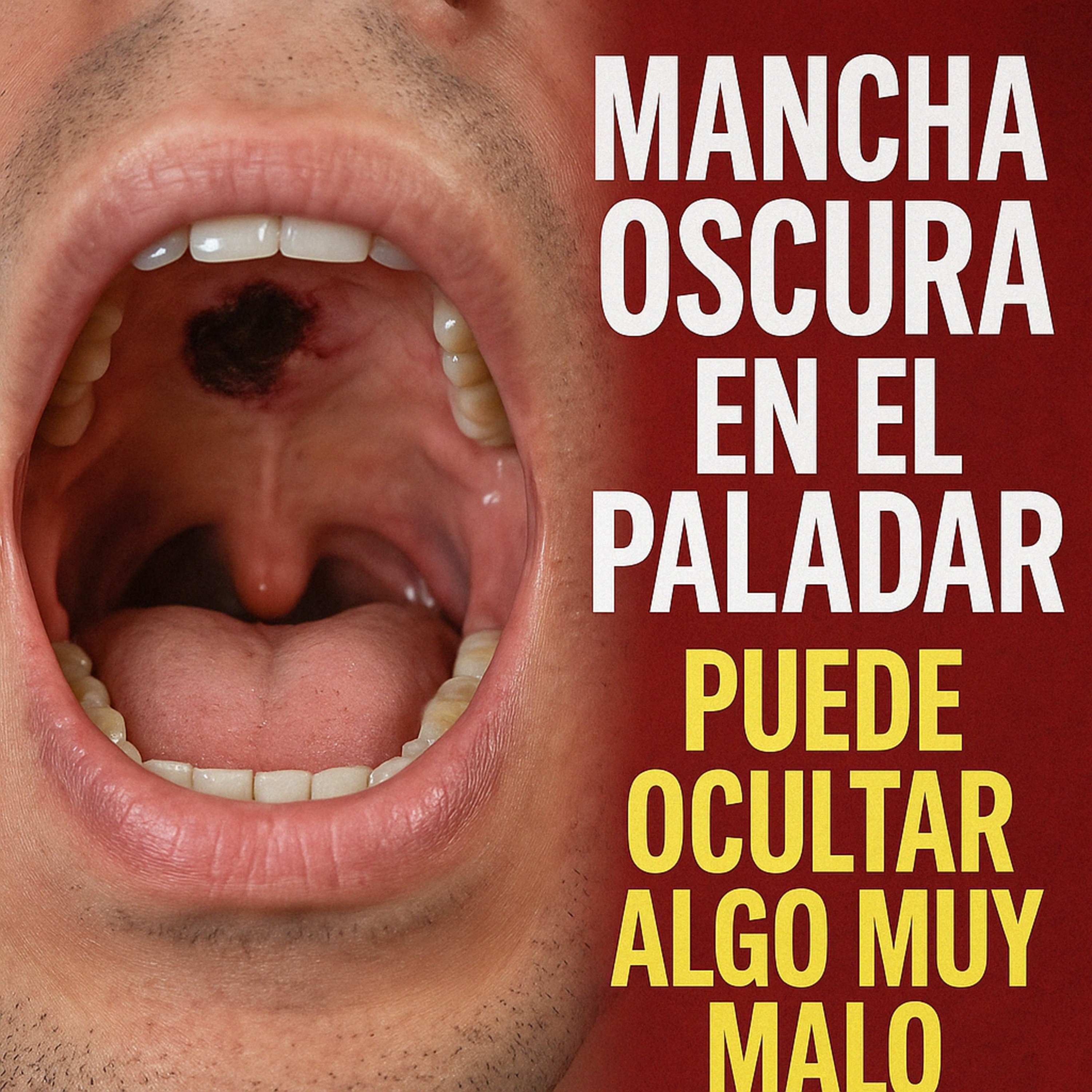 ¿Qué es esto? ¿Es papiloma? ¿Es peligroso? ¿Qué hago? episode artwork