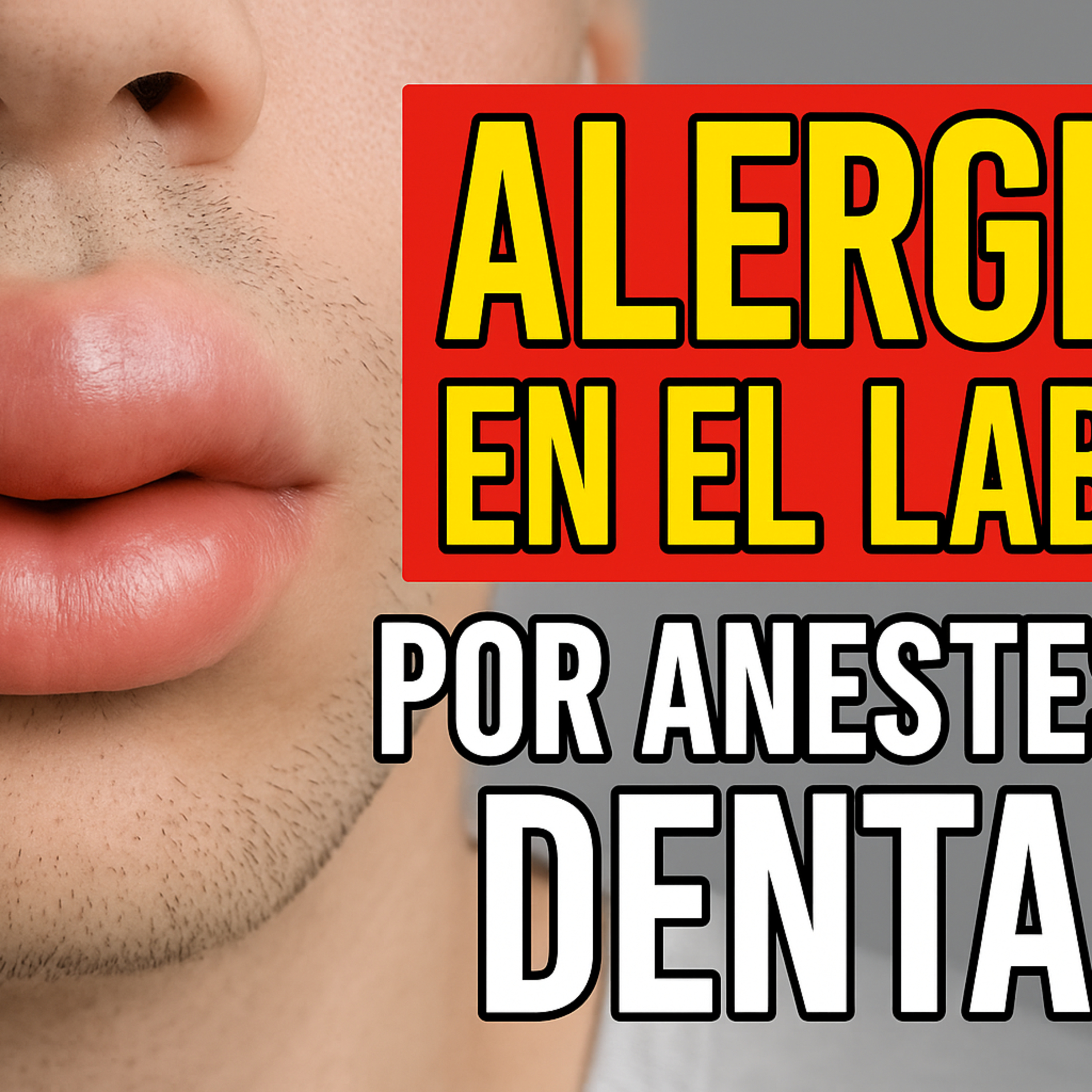 Se me inflamó el labio episode artwork