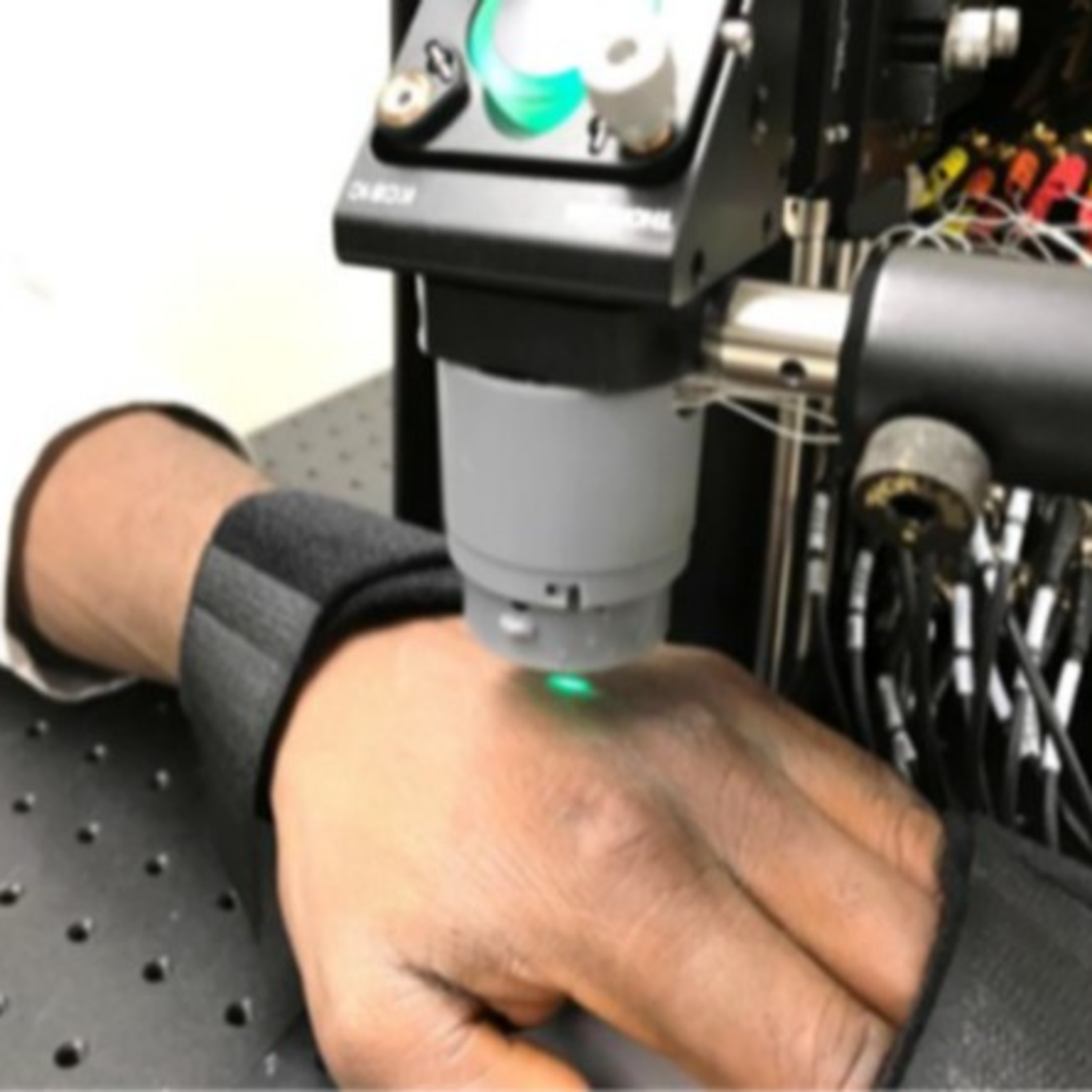 Detecting Malaria with Light and Sound Without Blood Draw Can Transform Global Health