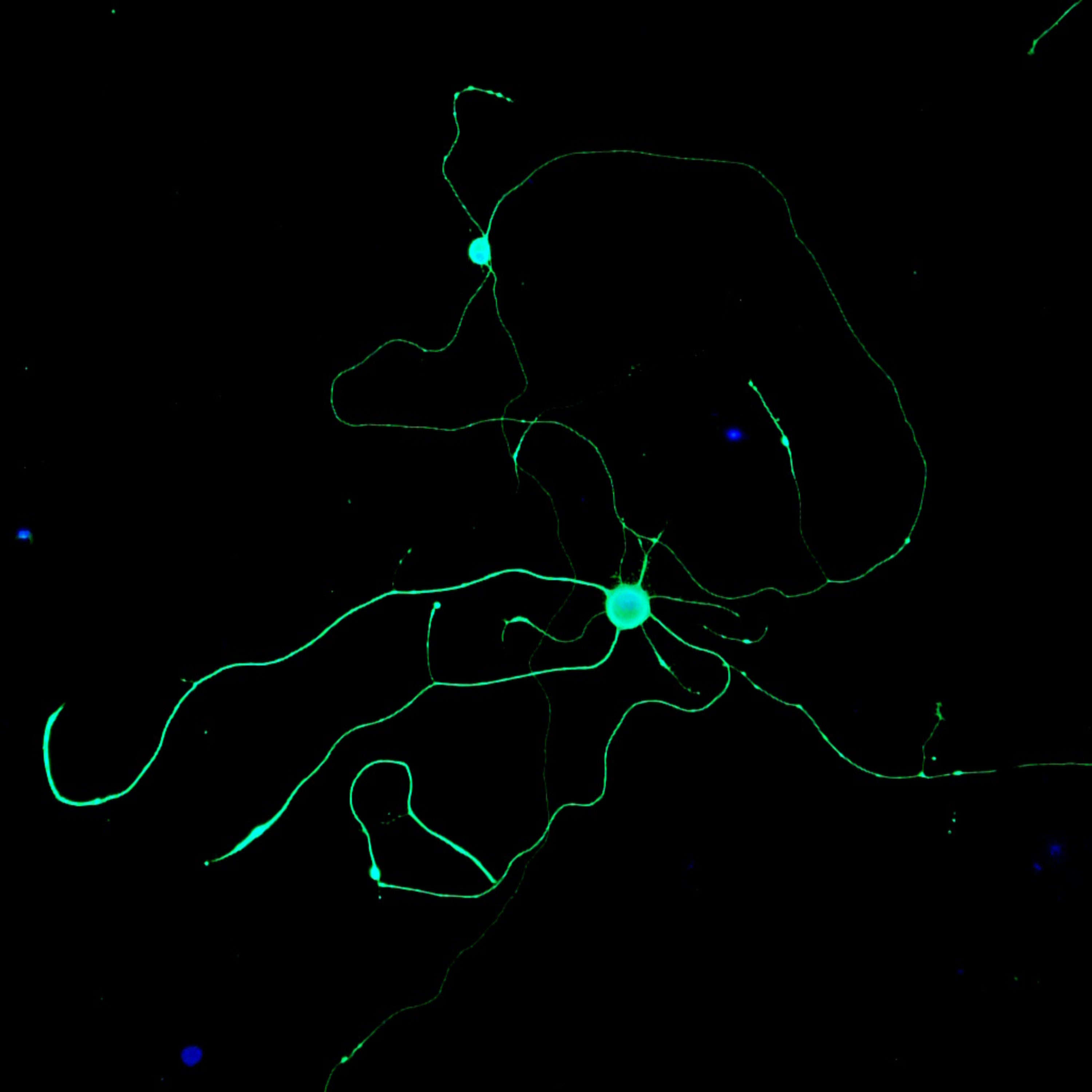 Blending Biology and Engineering to Repair Damaged Nerves