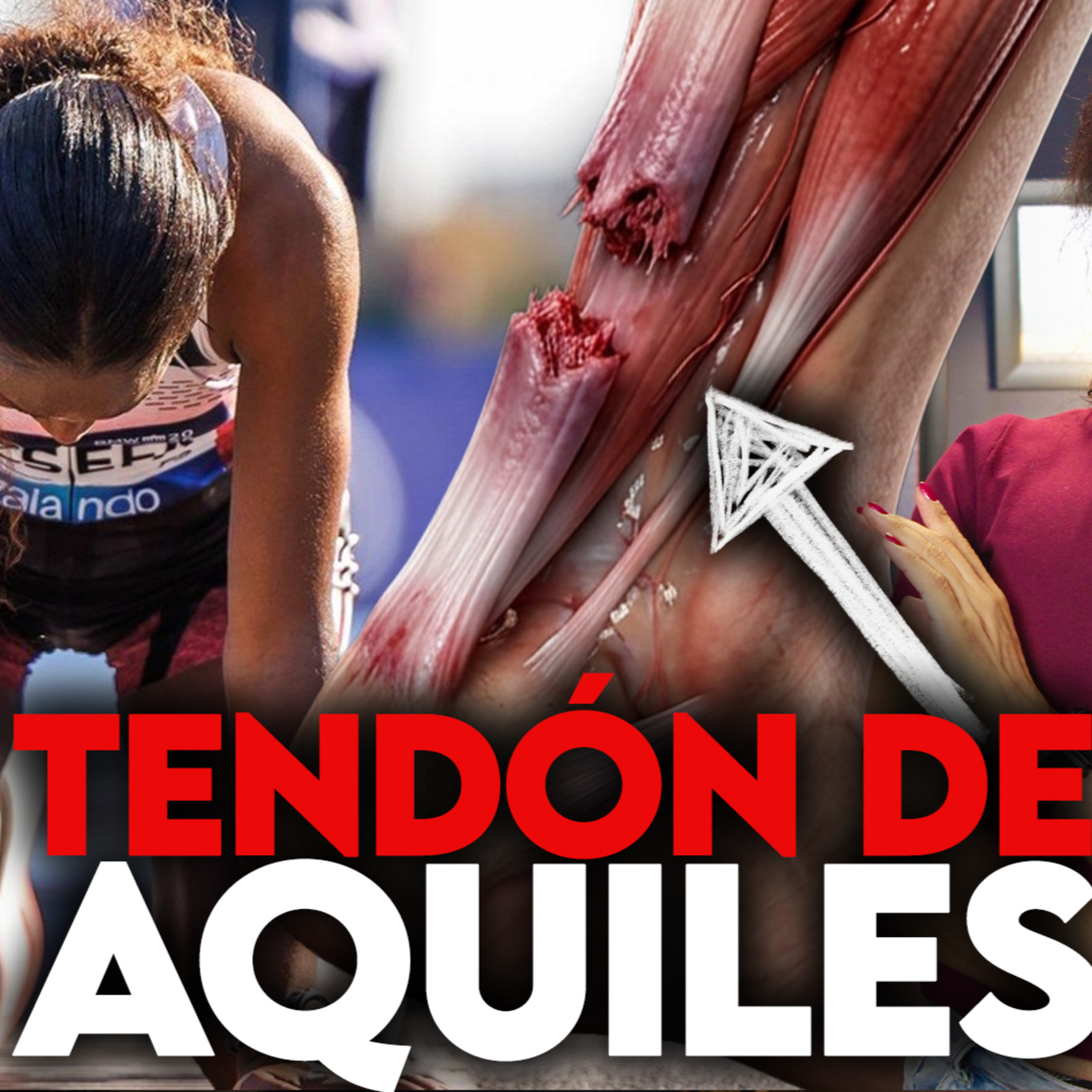 Tigst Assefa se rompió el tendón de Aquiles… ¿podría pasarte a ti? | Corre Fer Corre