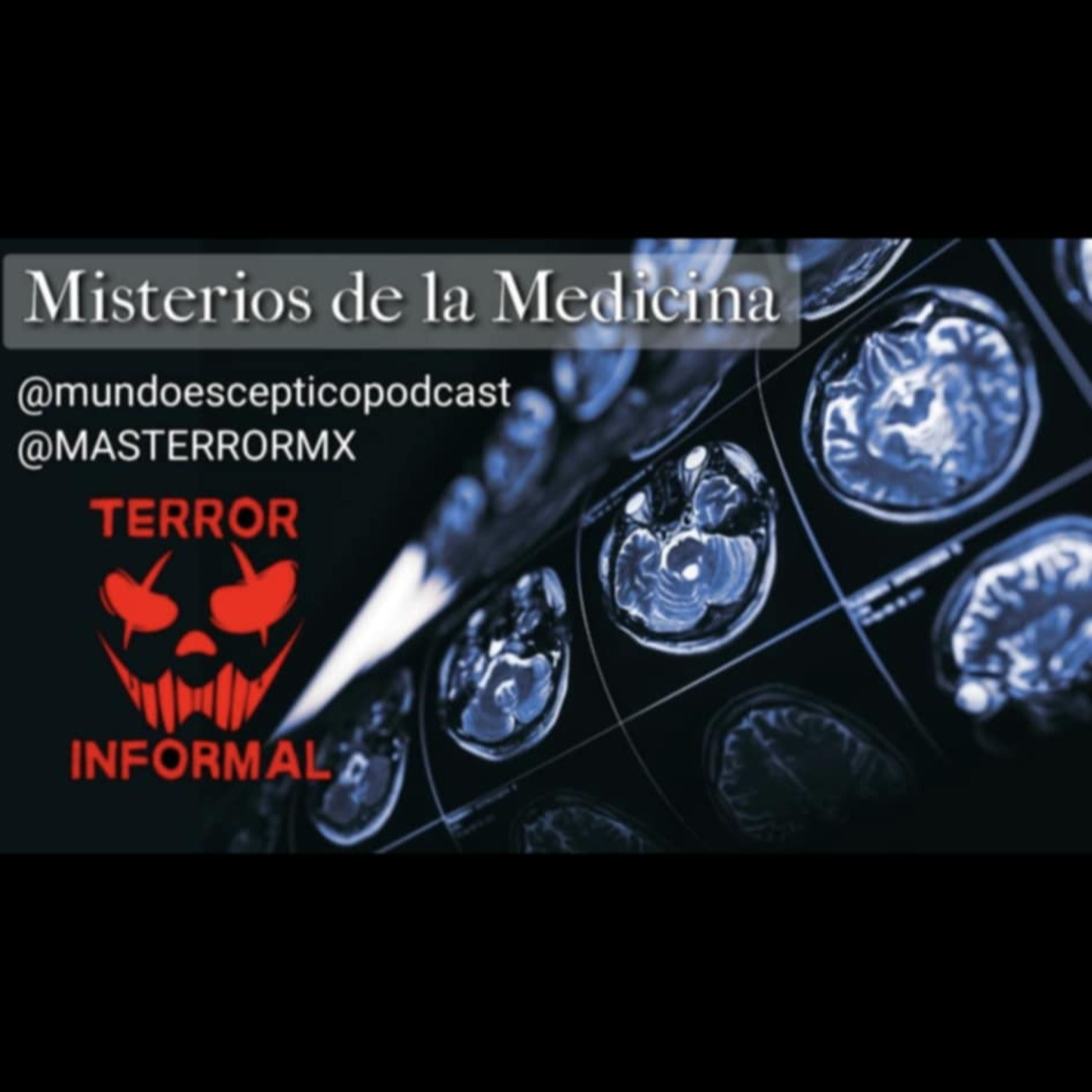 Mundo Escéptico