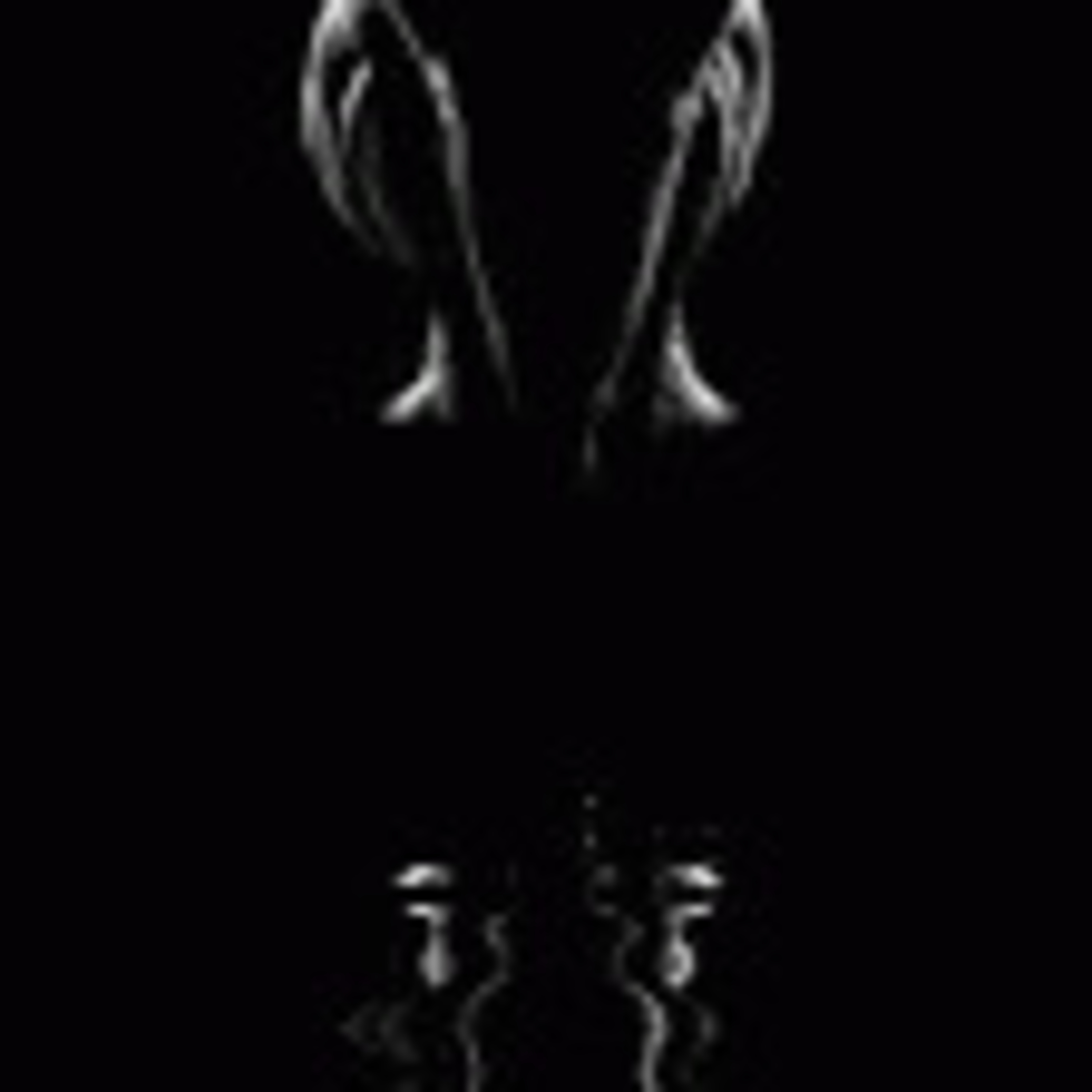 Black Harlequin The Romance Revealed