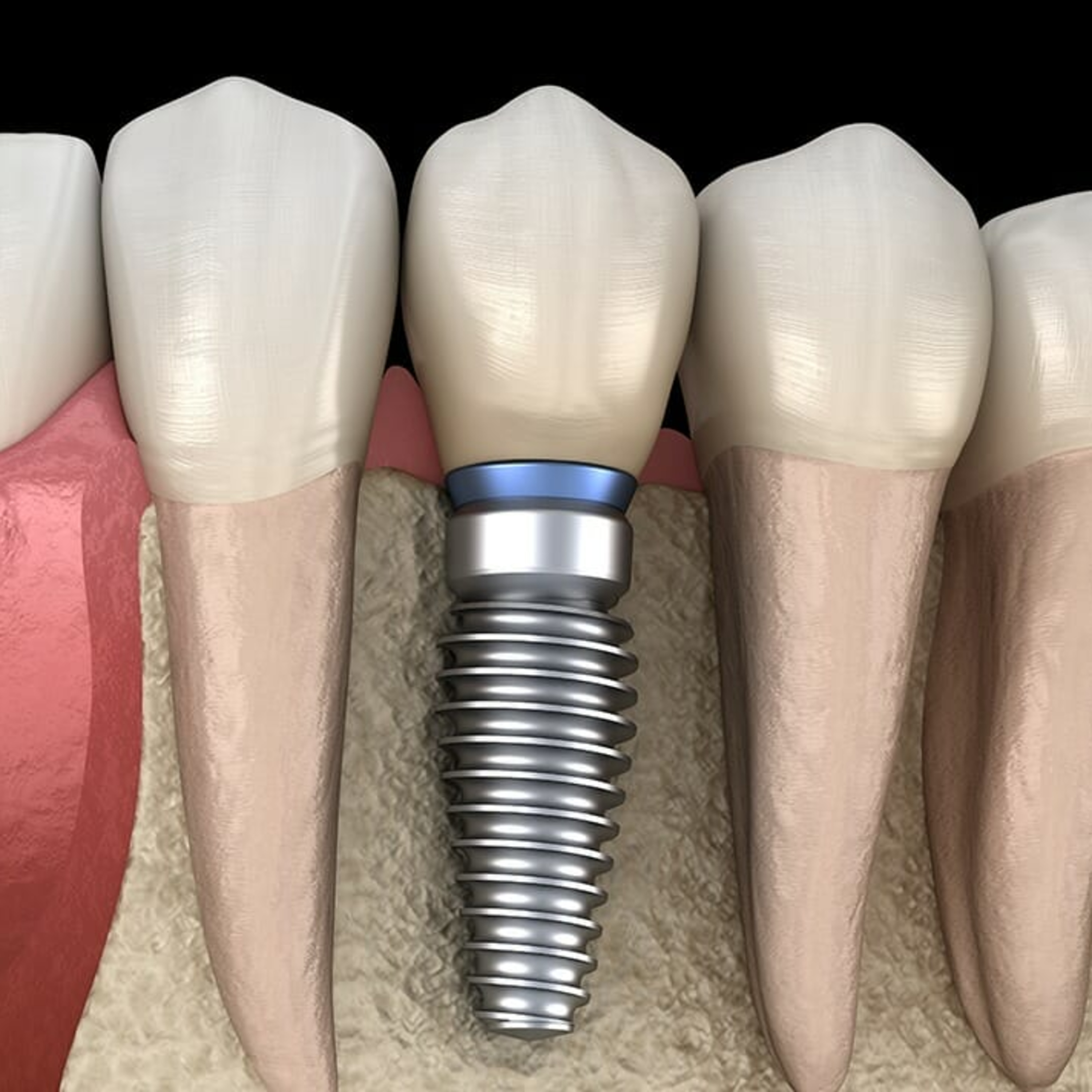 Today\'s RDH Dental Hygiene Podcast