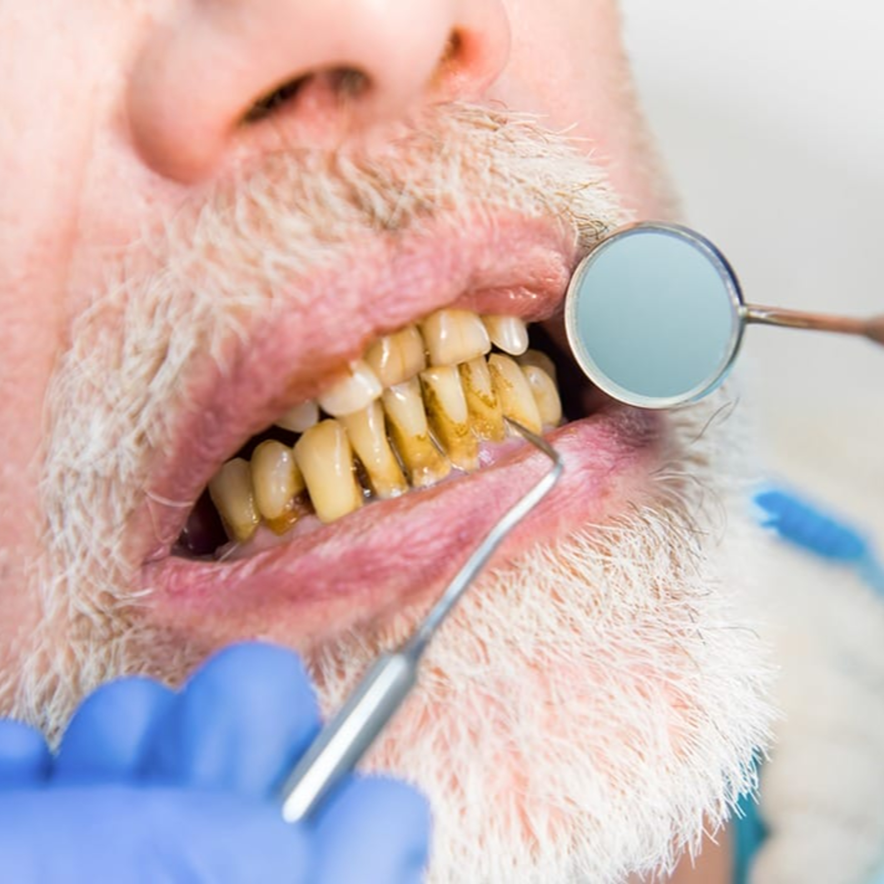 Today\'s RDH Dental Hygiene Podcast