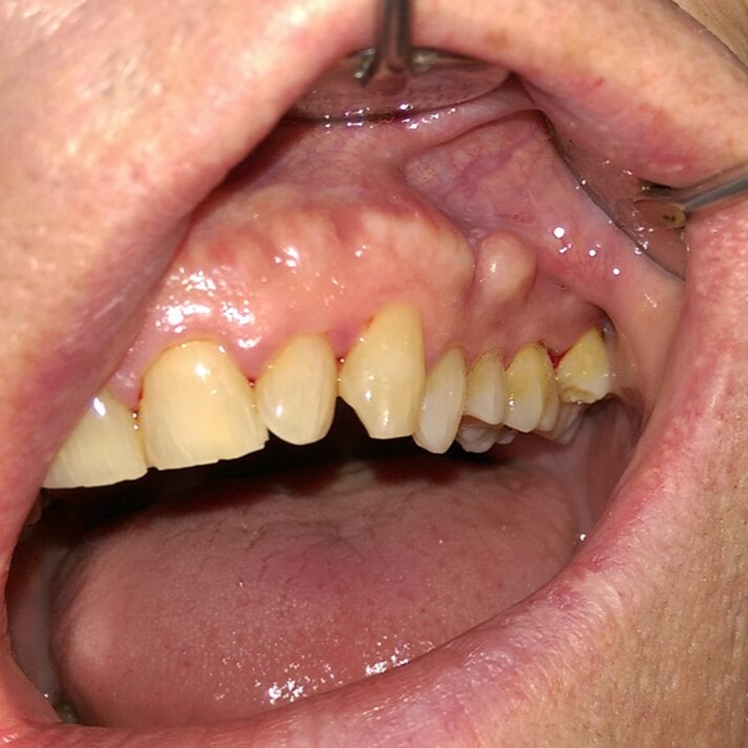 Today\'s RDH Dental Hygiene Podcast