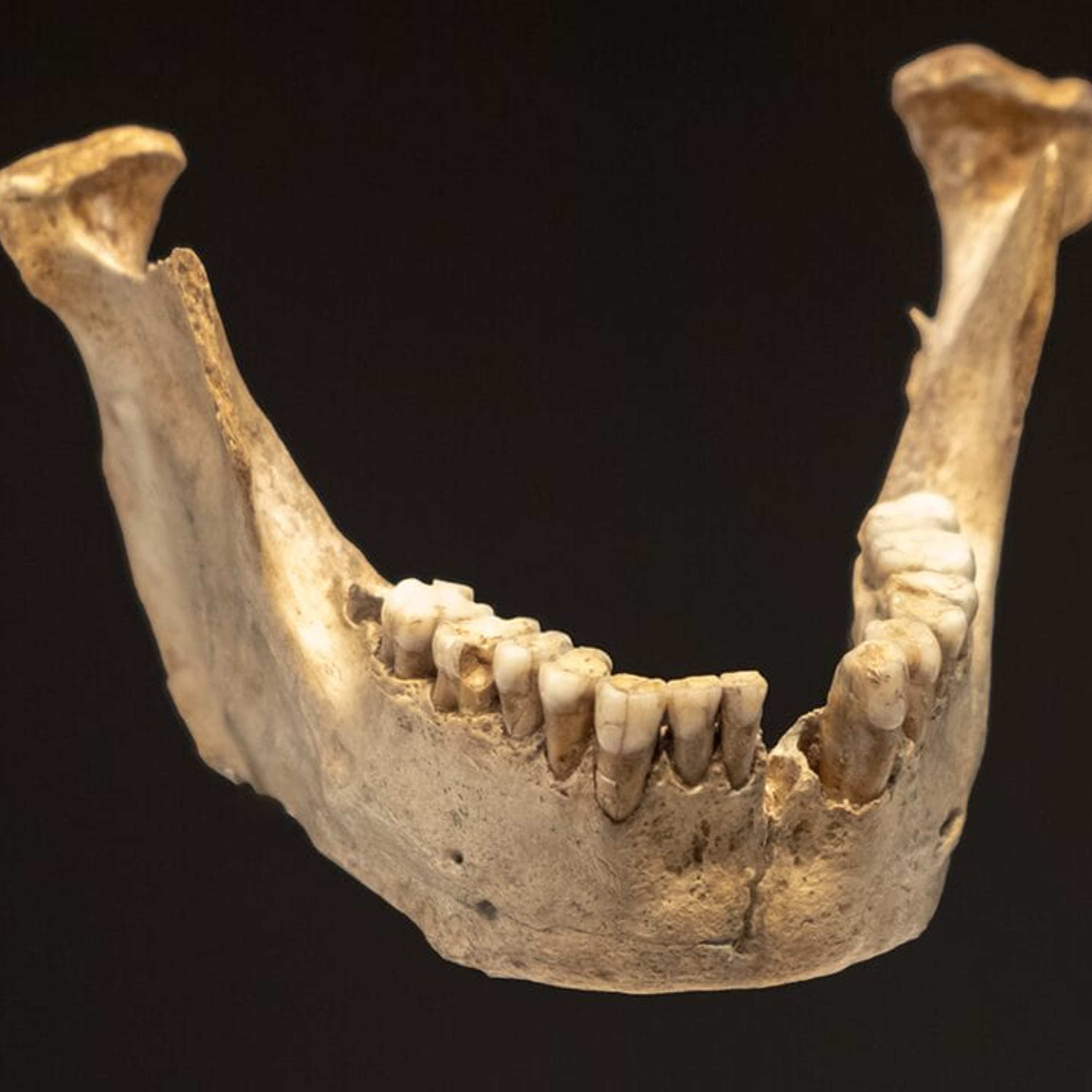 Audio Article: Ancient Teeth Reveal Insights into Evolution of Oral Microbiomes