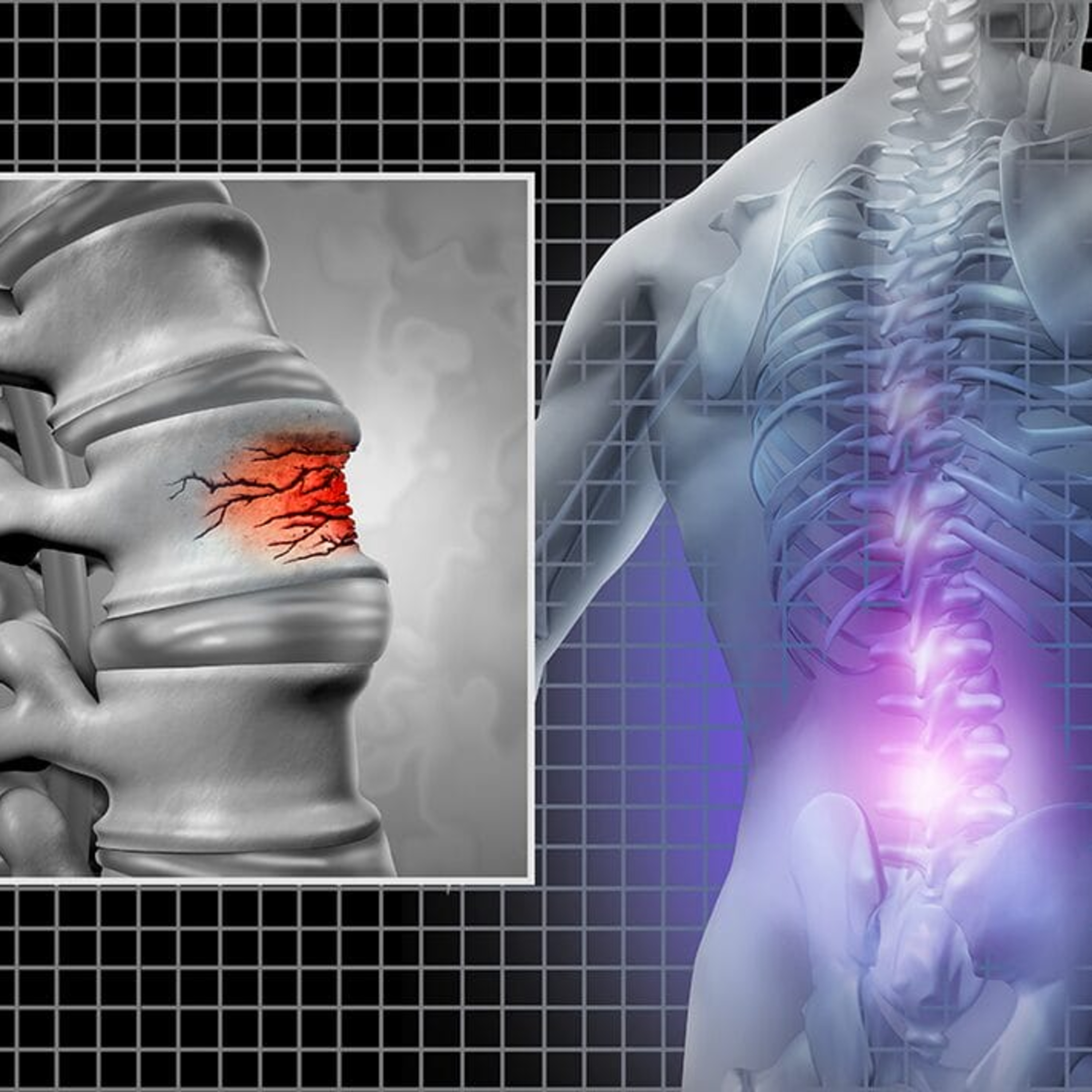 Audio Article: Research Explores Potential Association Between Oral Health and Osteoporotic Fracture Risk
