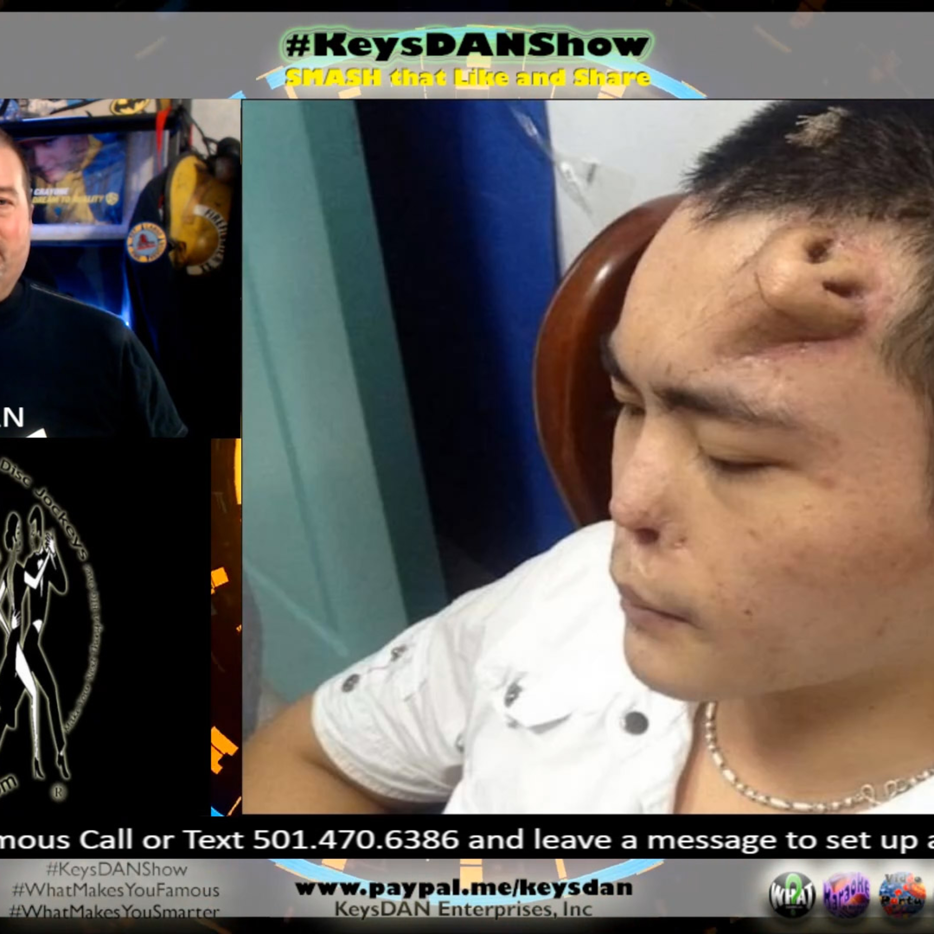 New Nose Grown On Forehead: Incredible Surgery Success! KeysDAN Show #Science #KeysDANShow @KeysDAN episode artwork