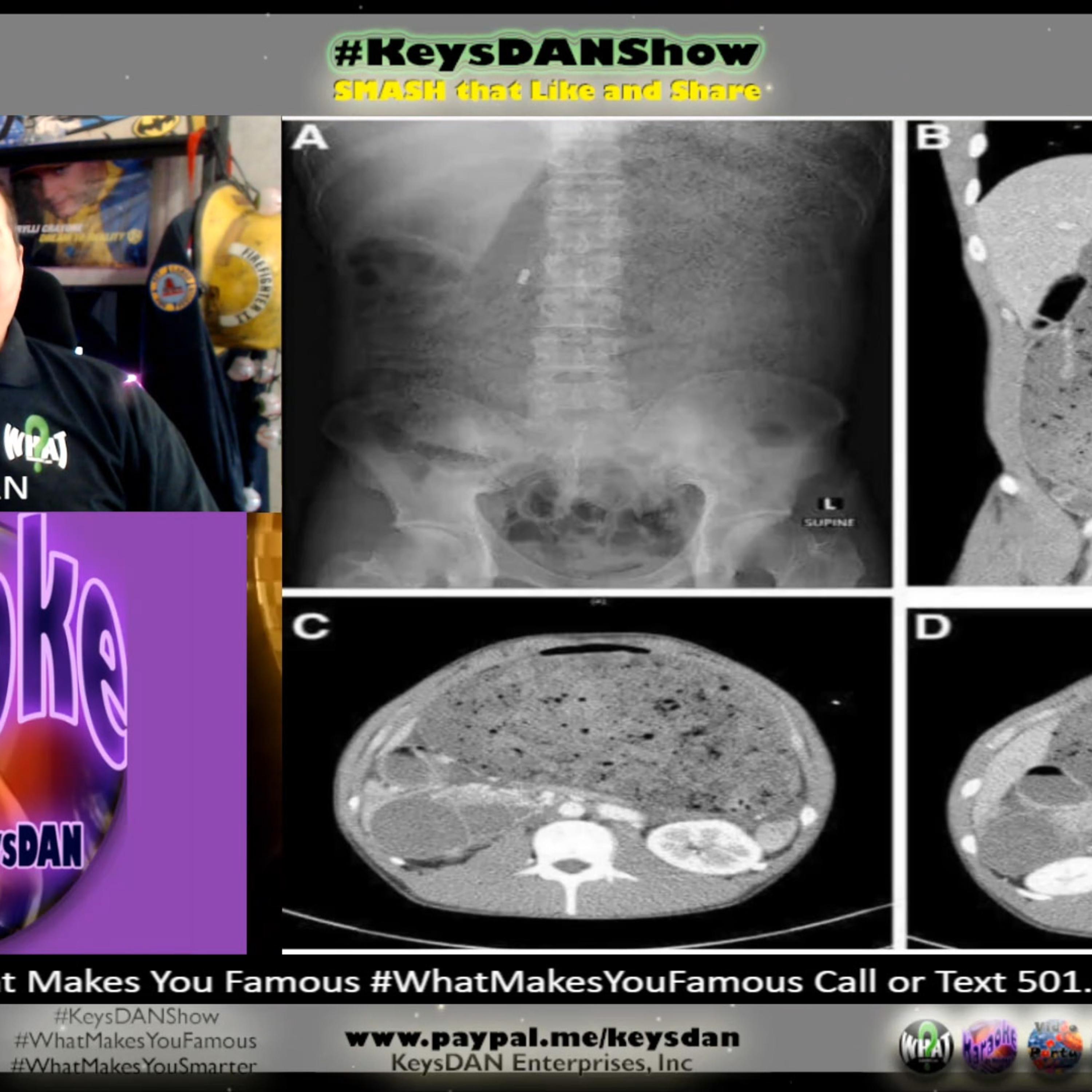 8lb Burger Eating Contest Gone WRONG! Extreme Danger! #HISTORY KeysDAN Show #KeysDANShow @KeysDAN episode artwork