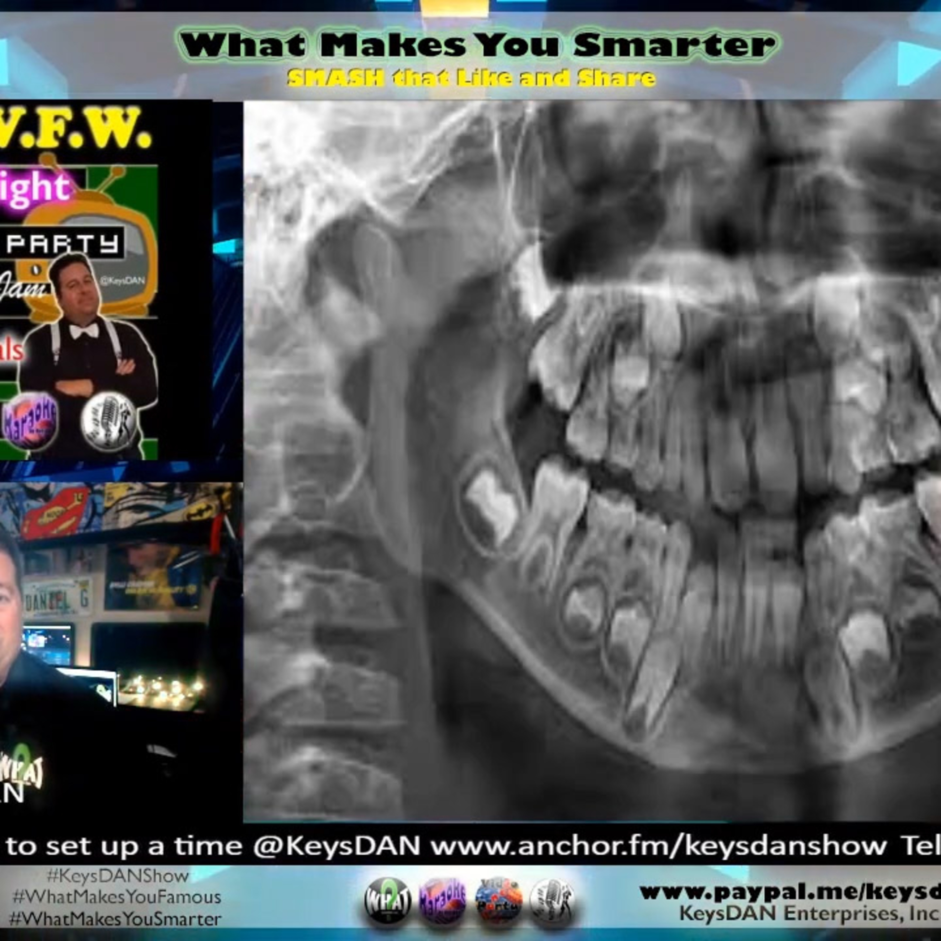Why Do We Have Wisdom Teeth? The Evolution Explained KeysDAN Show #Health #KeysDANShow @KeysDAN episode artwork