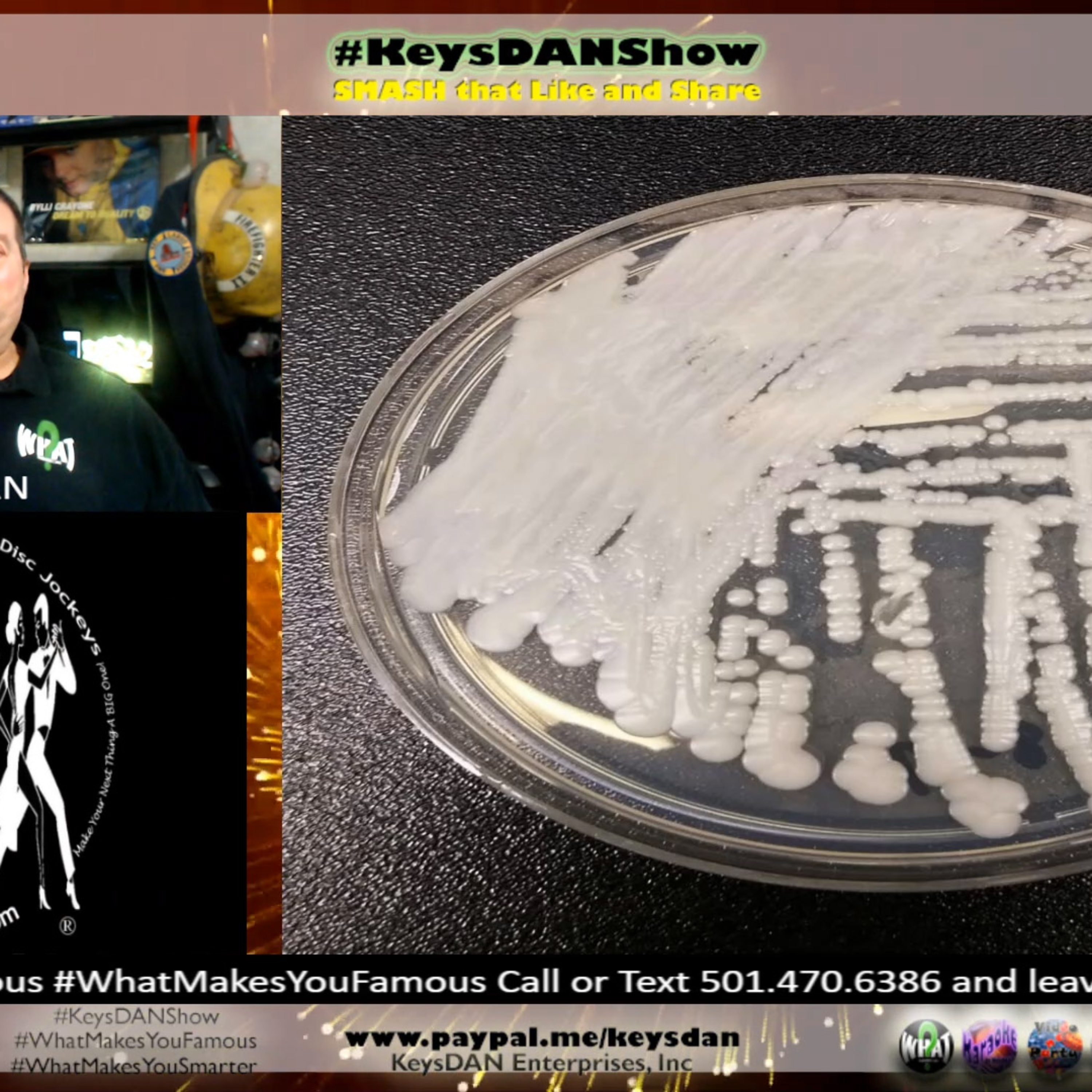 Candida Auris: The Spreading Superbug Explained KeysDAN Show #Health #KeysDANShow @KeysDAN episode artwork