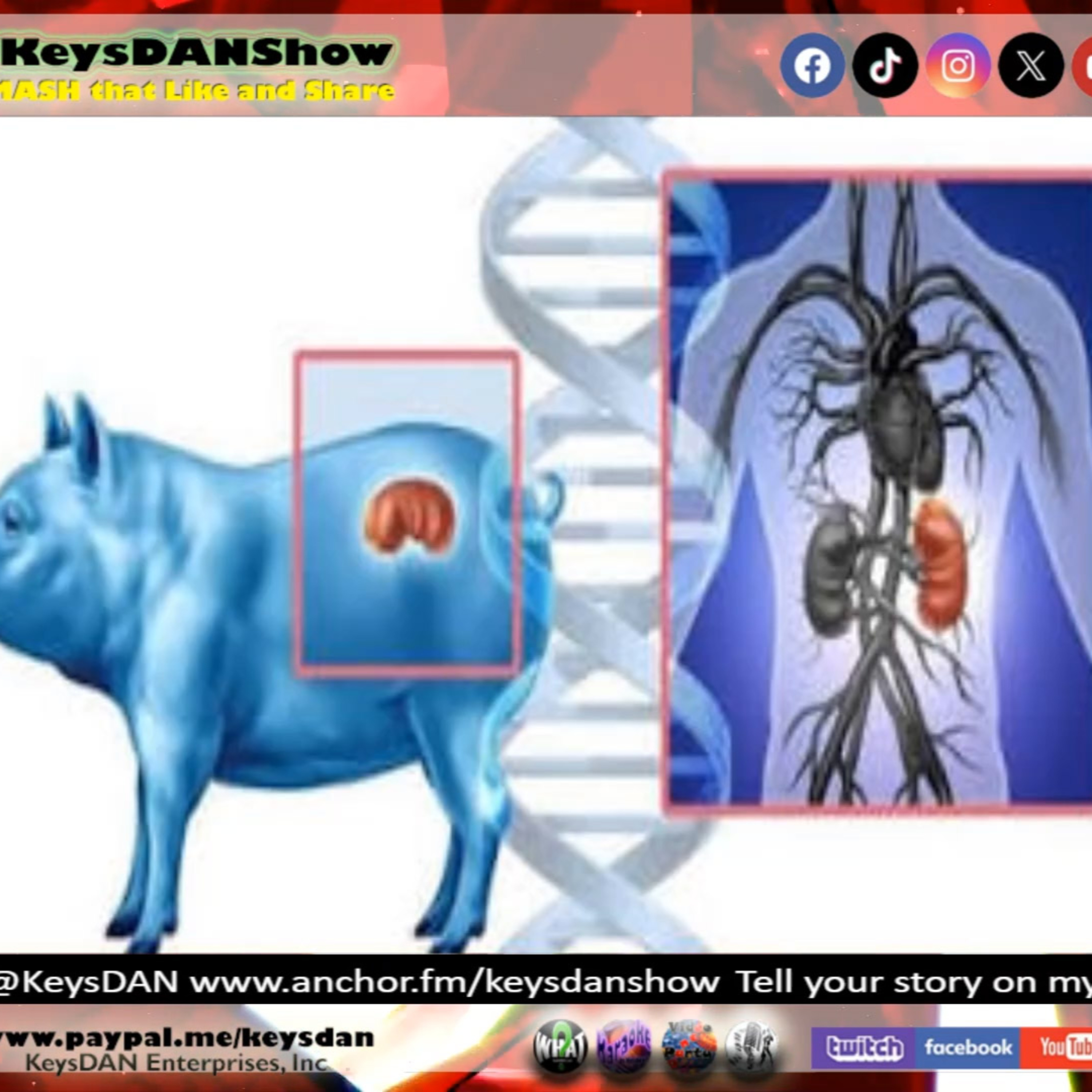 Pig Kidney Transplant: Woman Lives 9+ Months! KeysDAN Show #Health #KeysDANShow @KeysDAN episode artwork