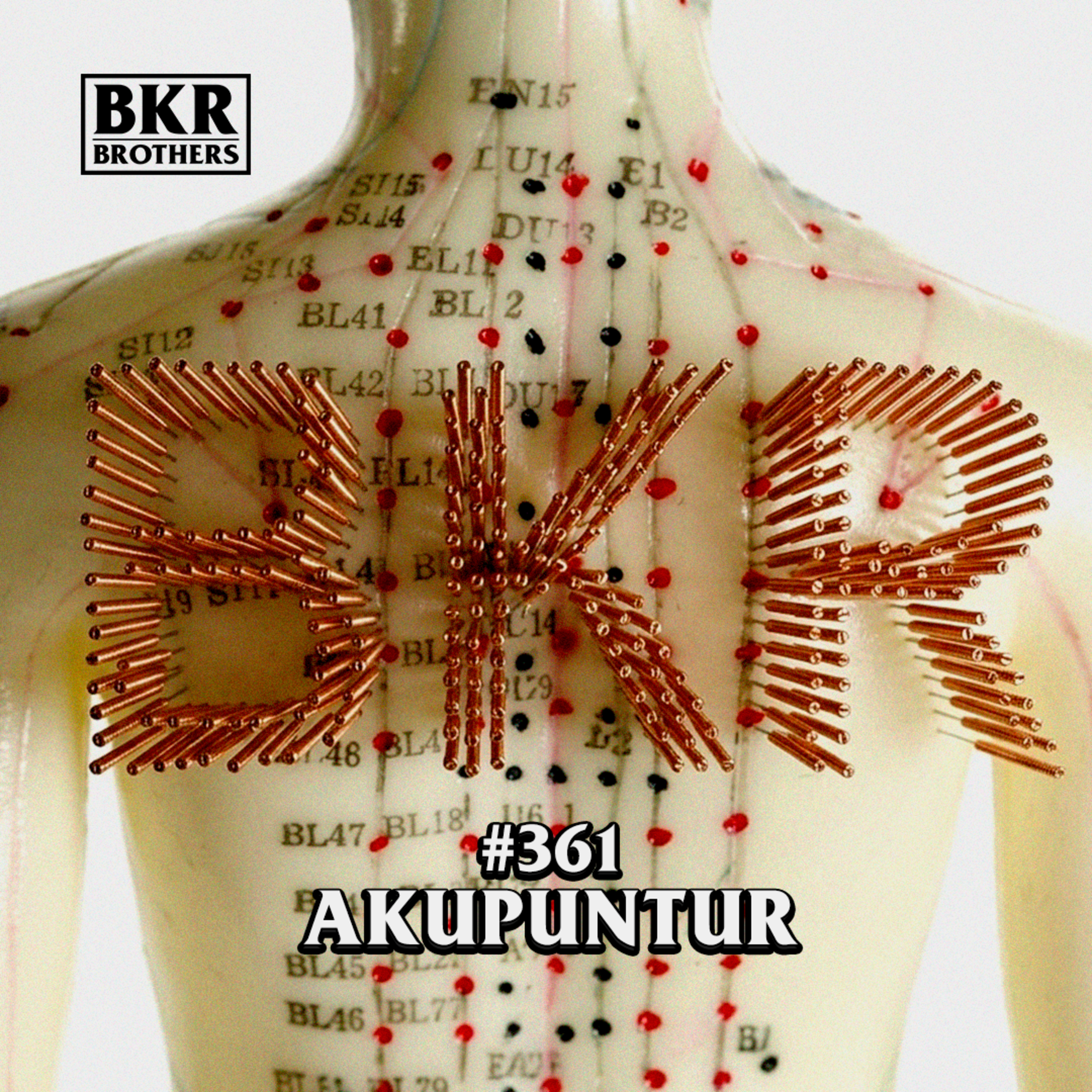 #361 Akupuntur episode artwork