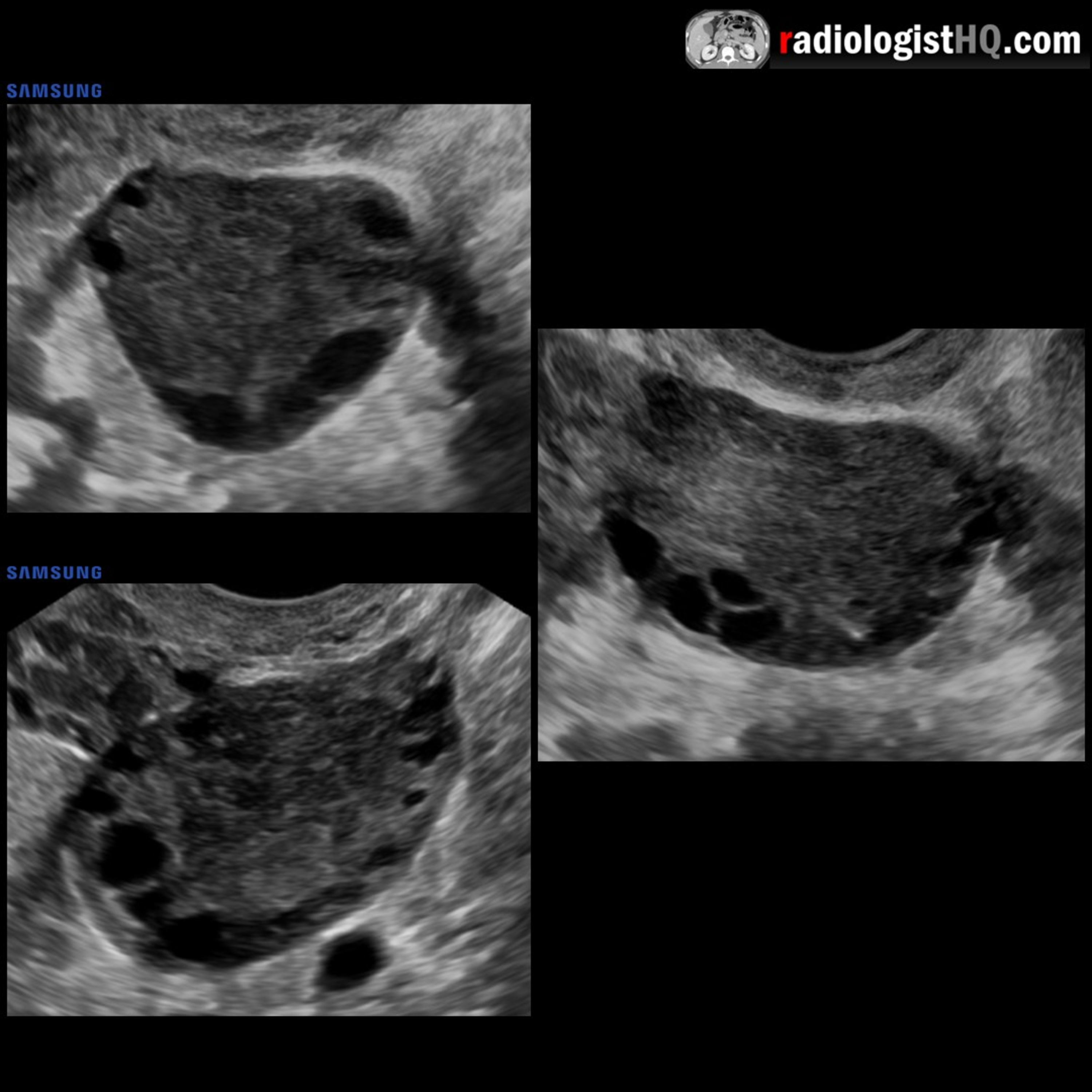 Radiology Lectures | Radquarters