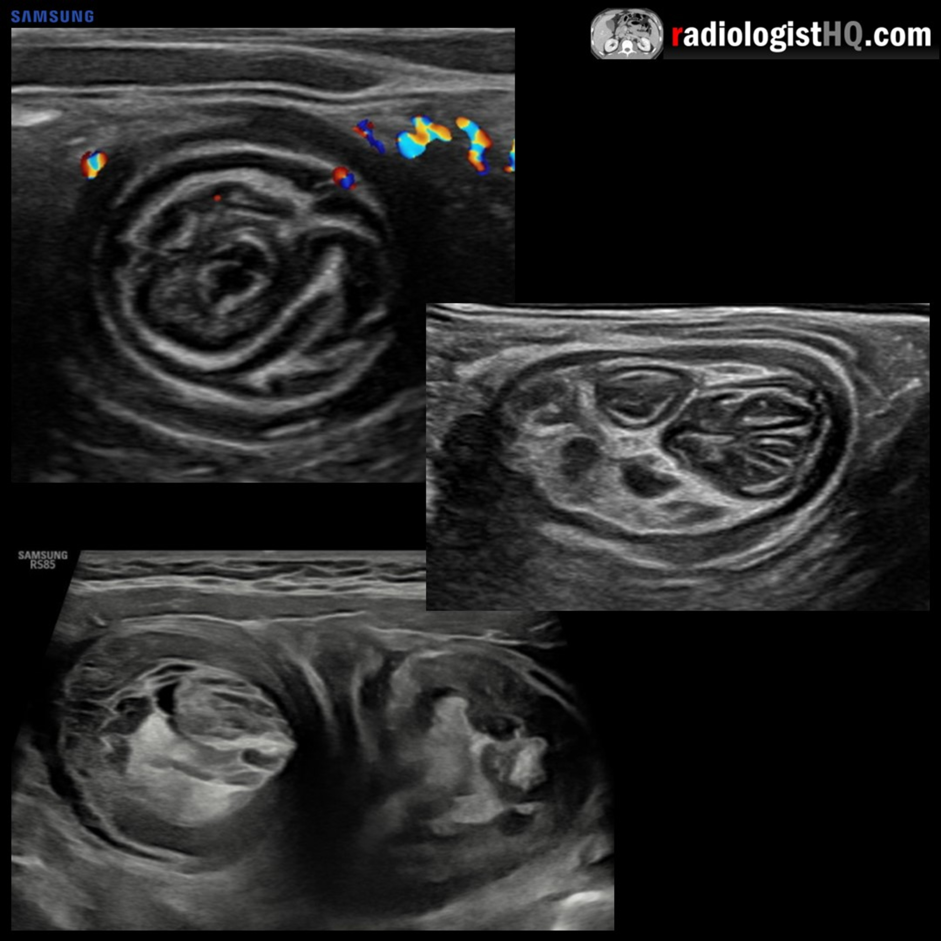 Radiology Lectures | Radquarters