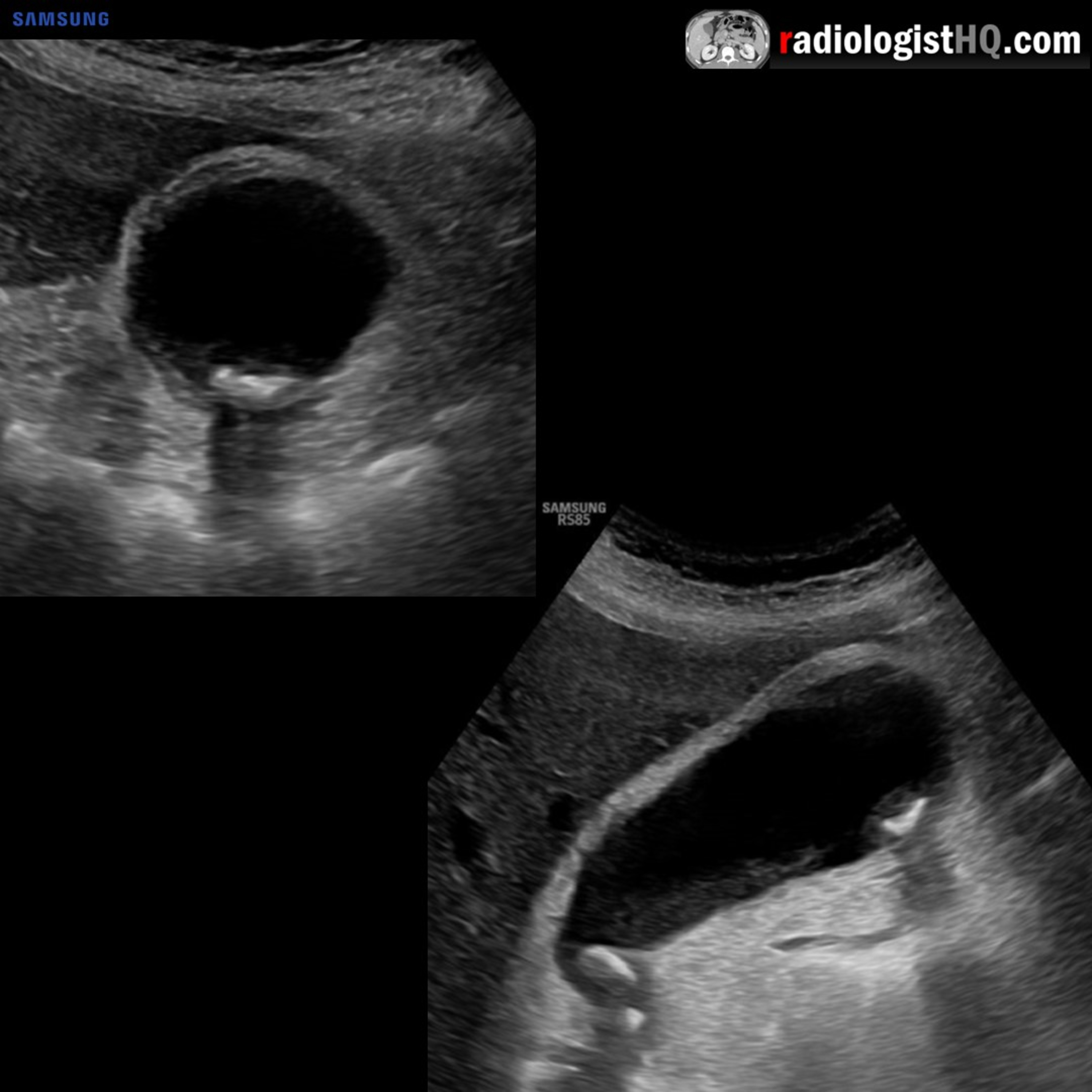 Radiology Lectures | Radquarters