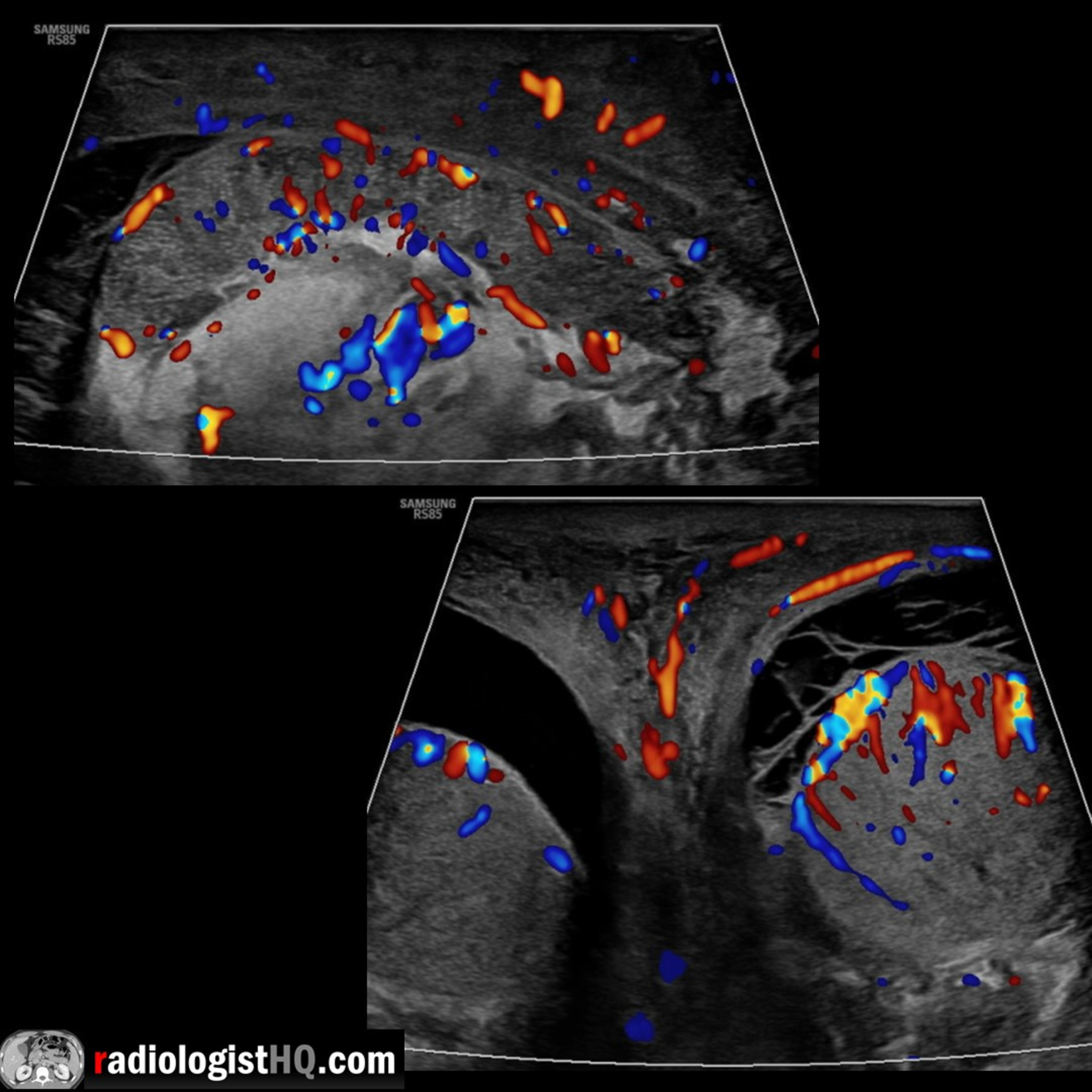 Radiology Lectures | Radquarters
