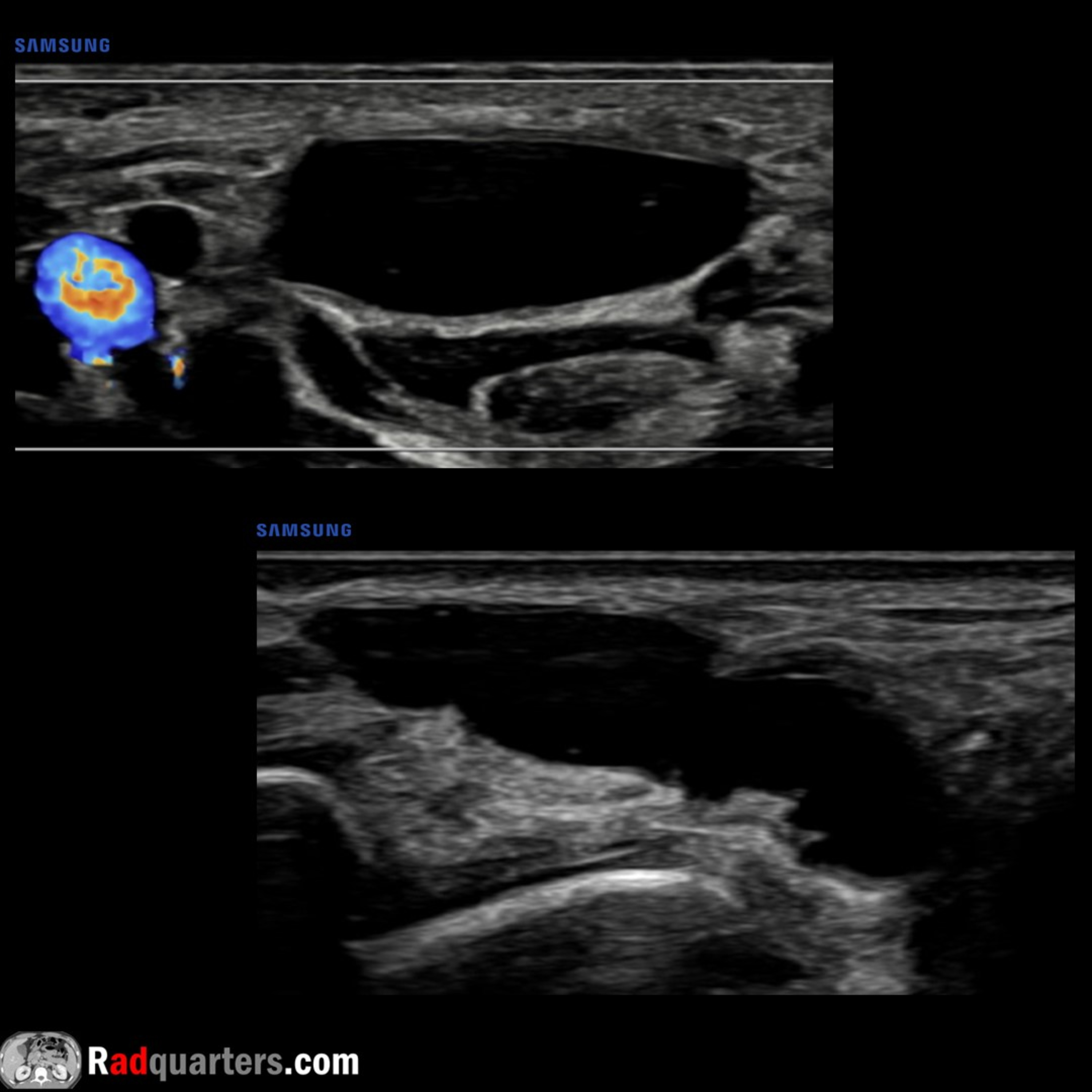 Radiology Lectures | Radquarters