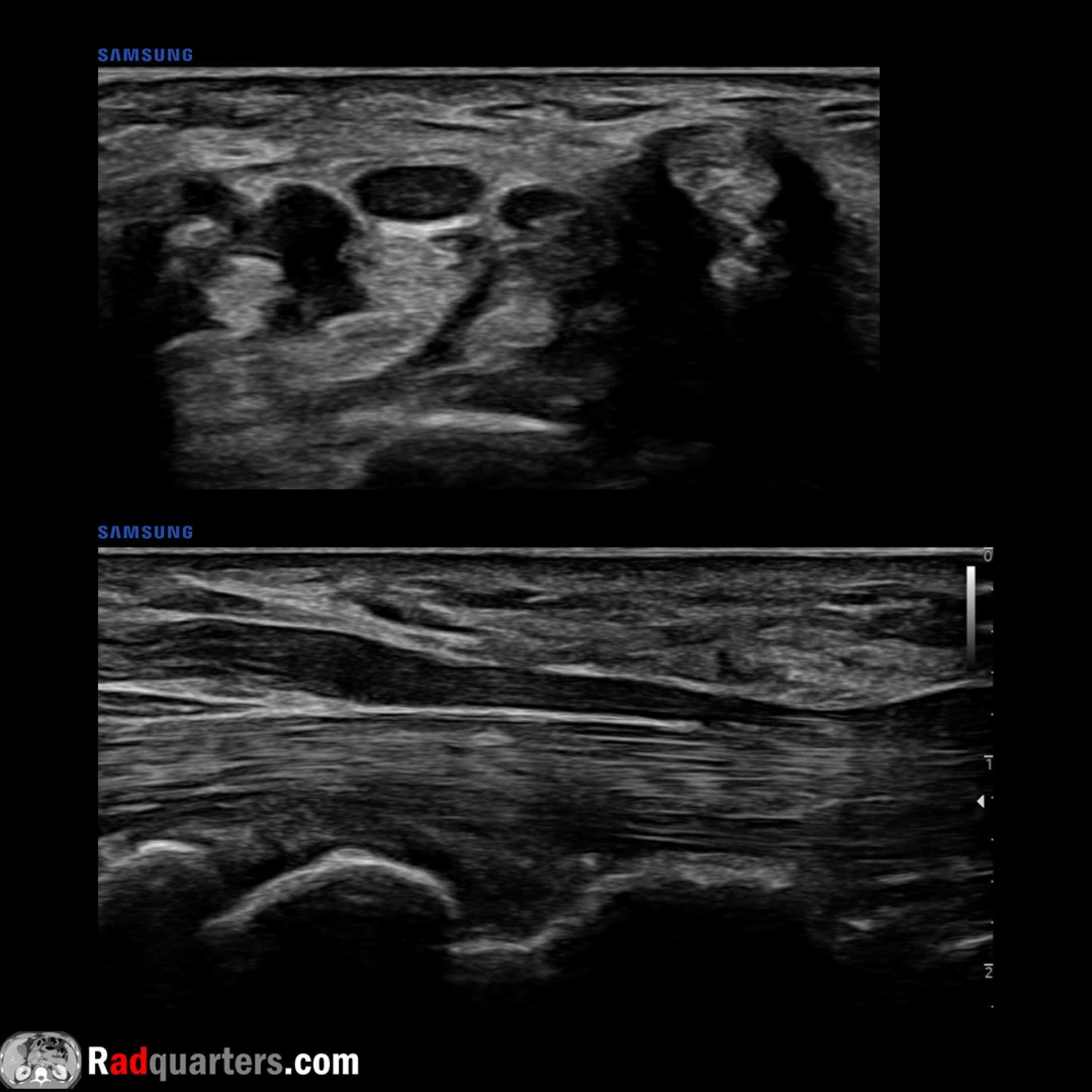 Radiology Lectures | Radquarters