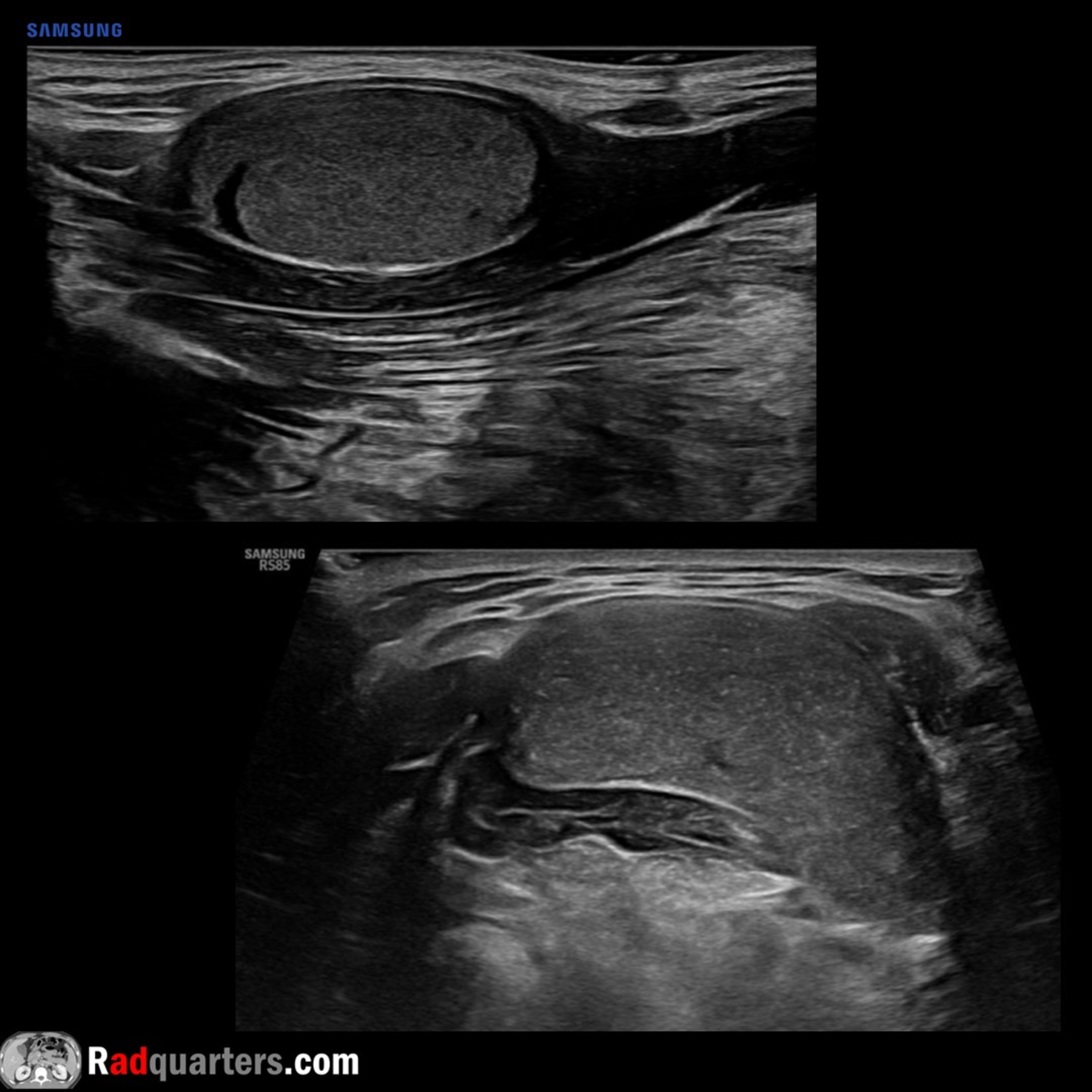 Radiology Lectures | Radquarters