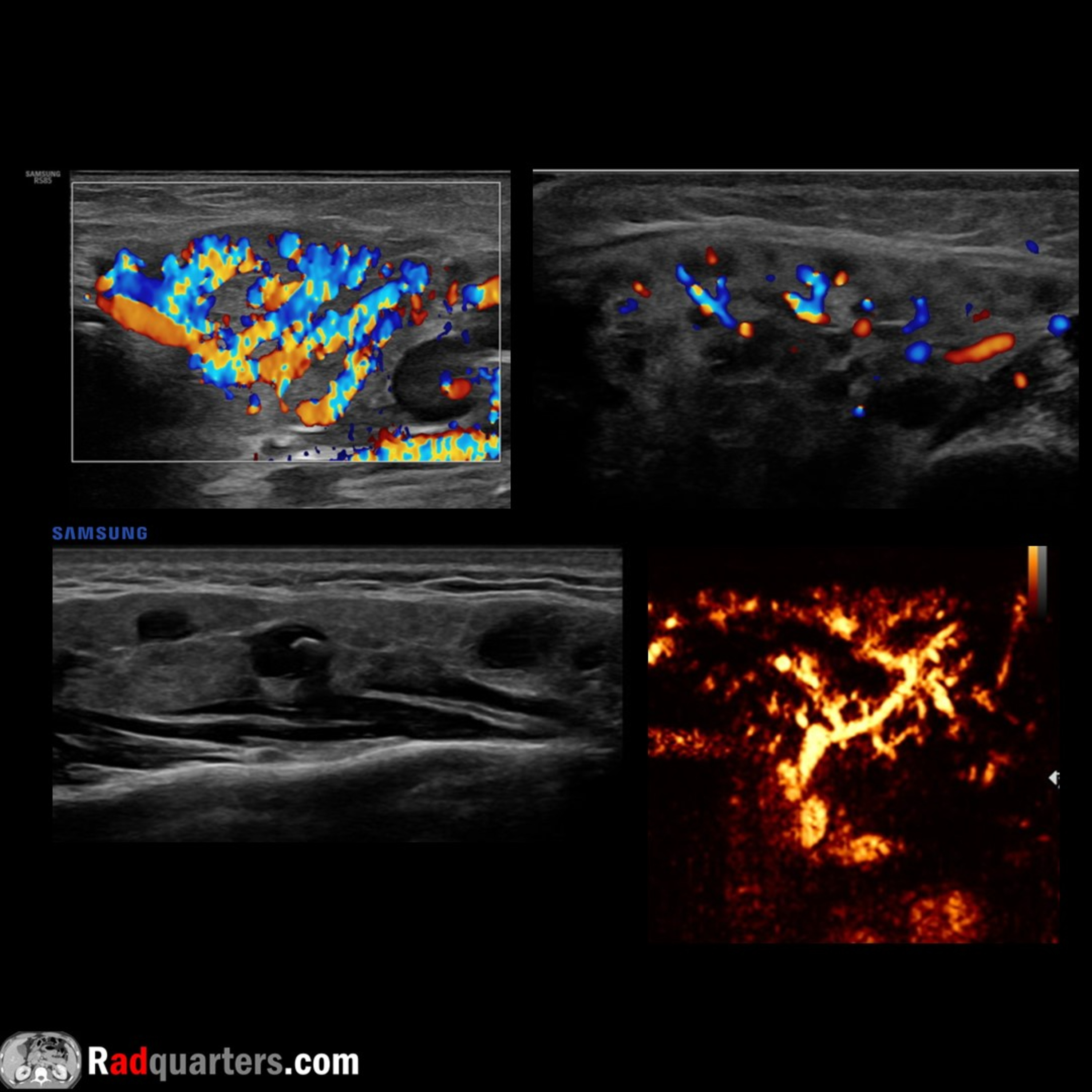Radiology Lectures | Radquarters