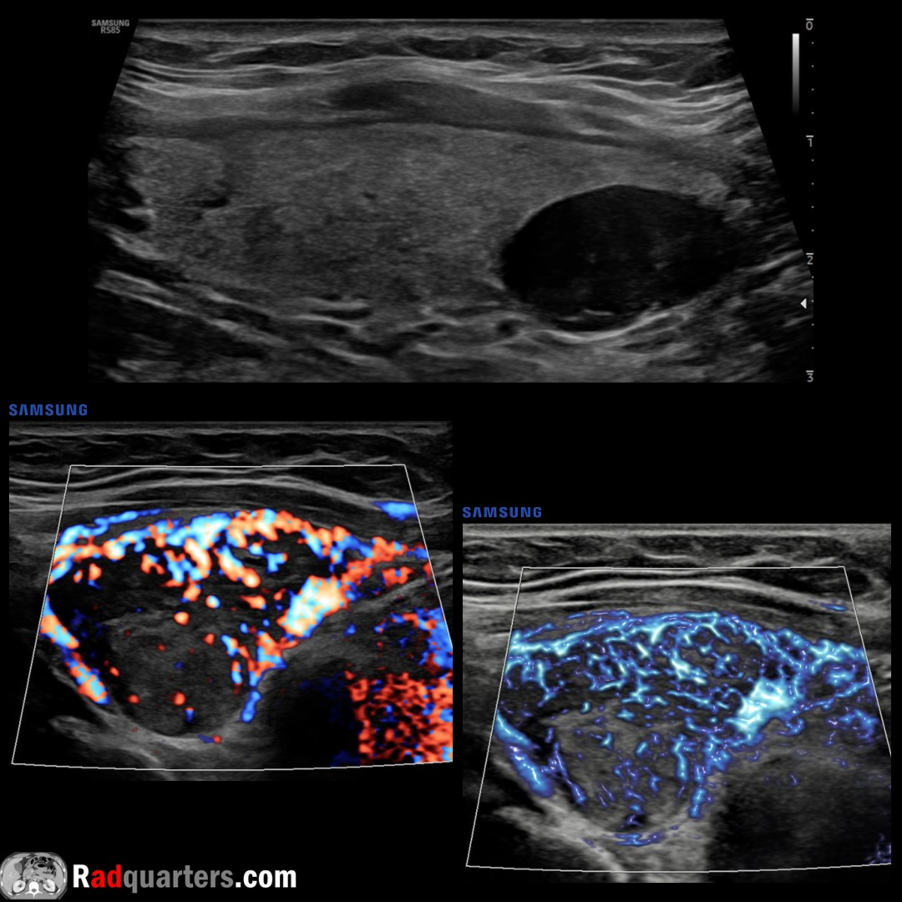 Radiology Lectures | Radquarters