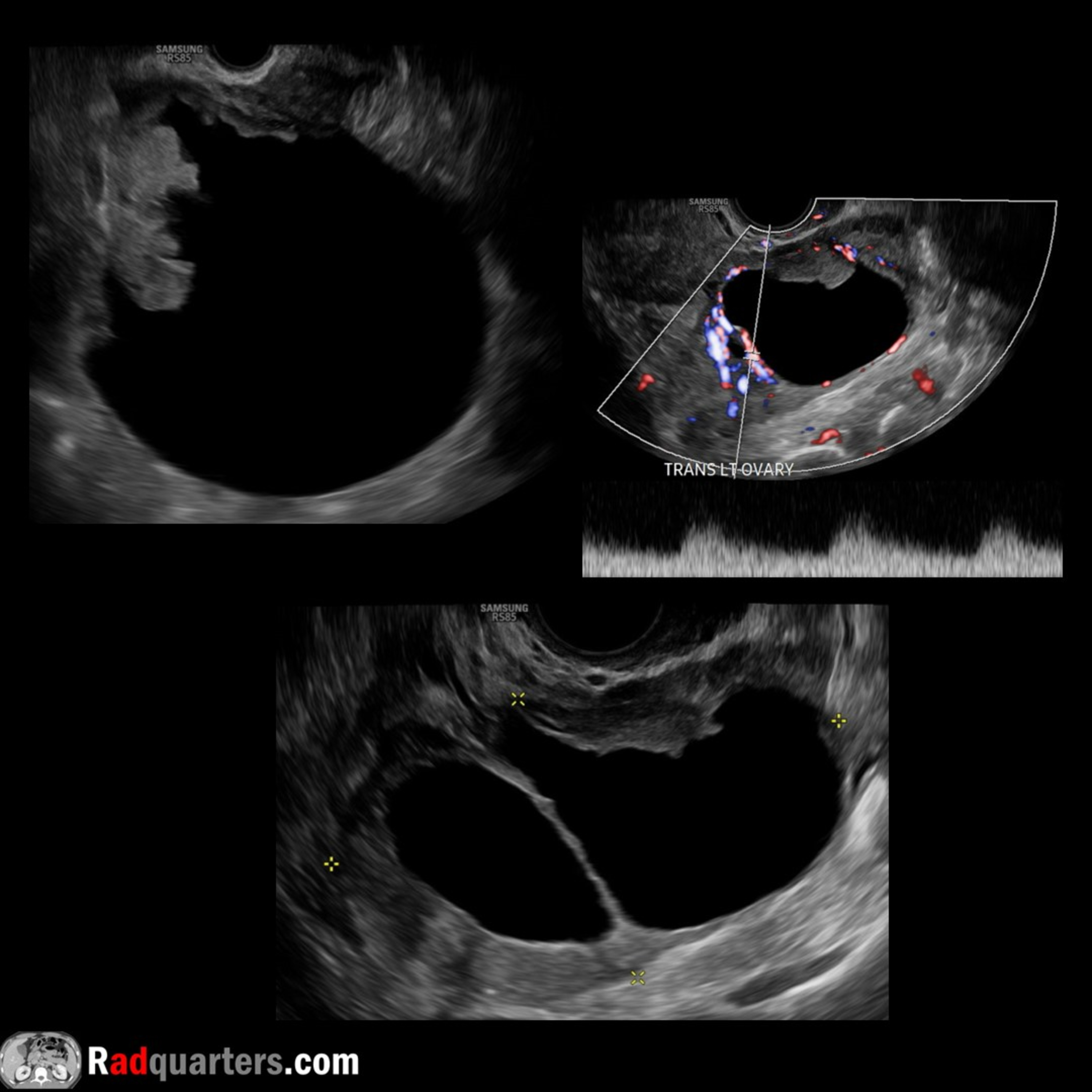 Radiology Lectures | Radquarters