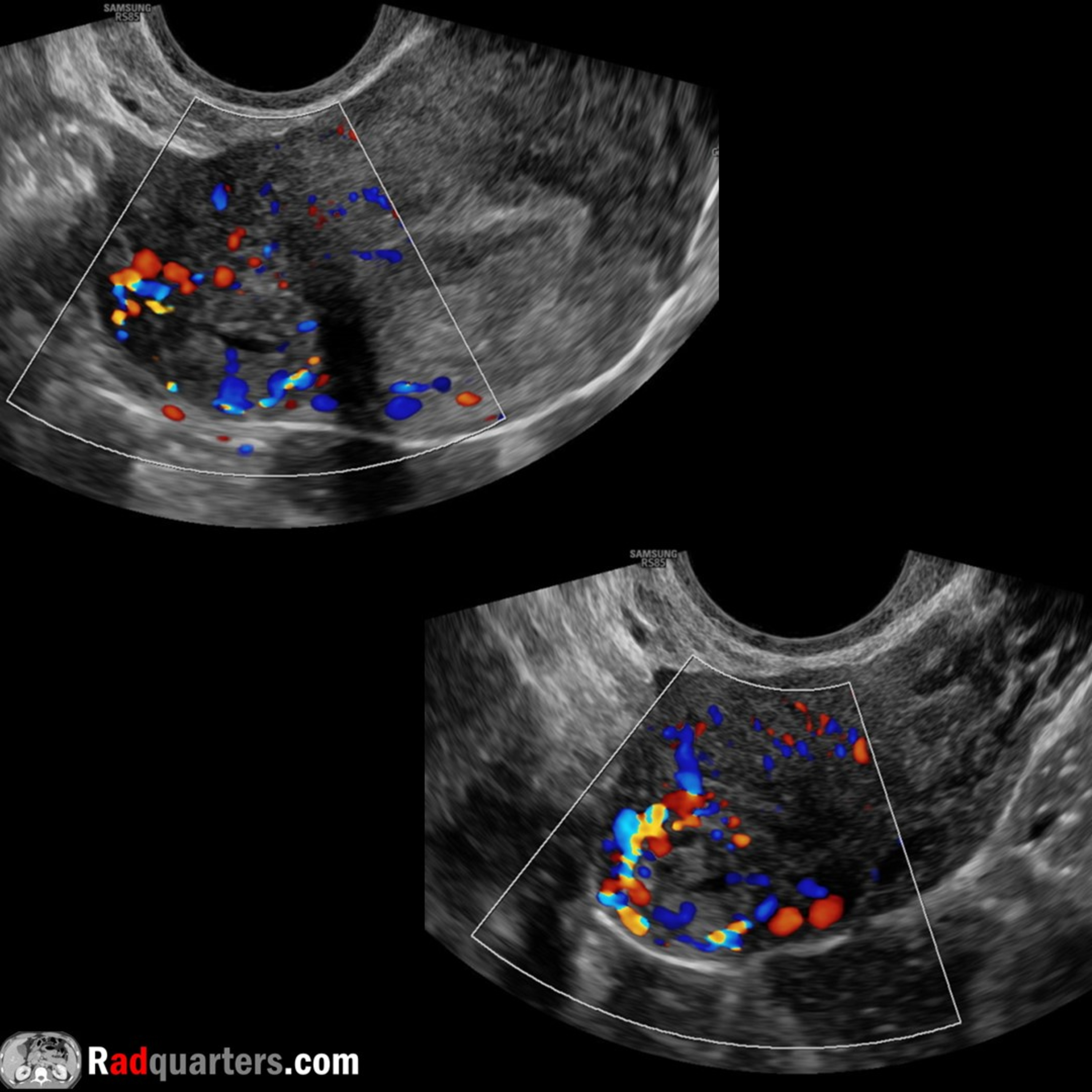 Radiology Lectures | Radquarters