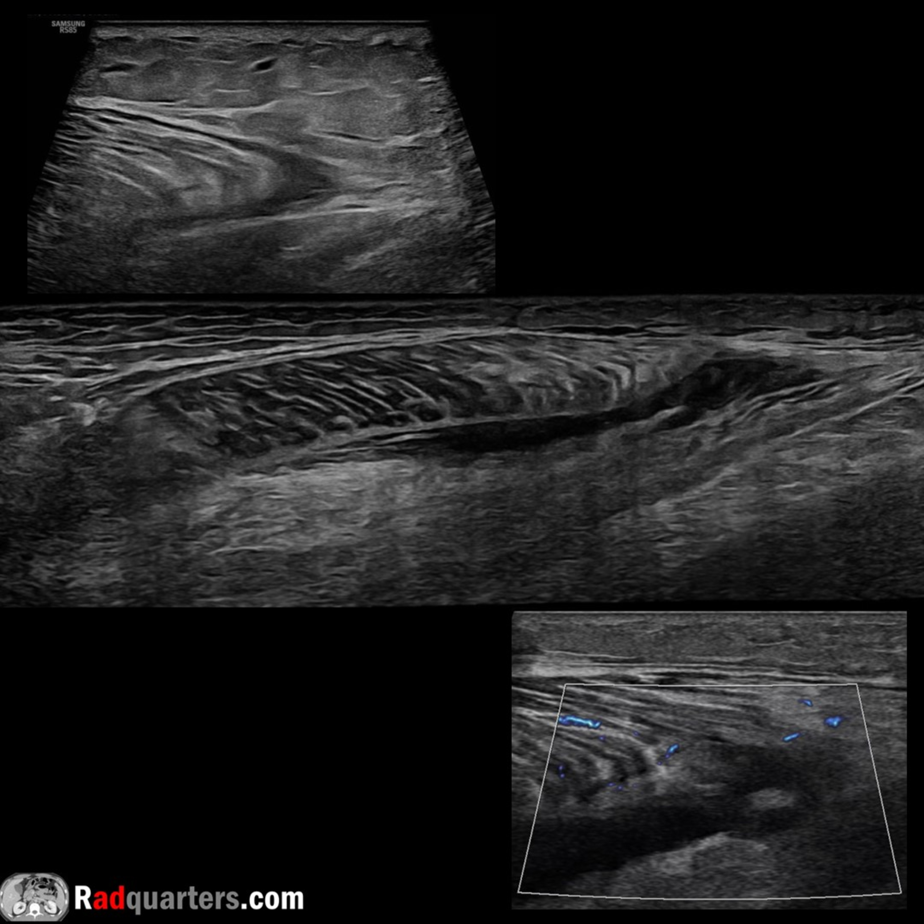 Radiology Lectures | Radquarters
